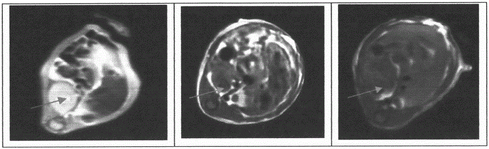 A multi-modal imaging microbubble structure, preparation method and application