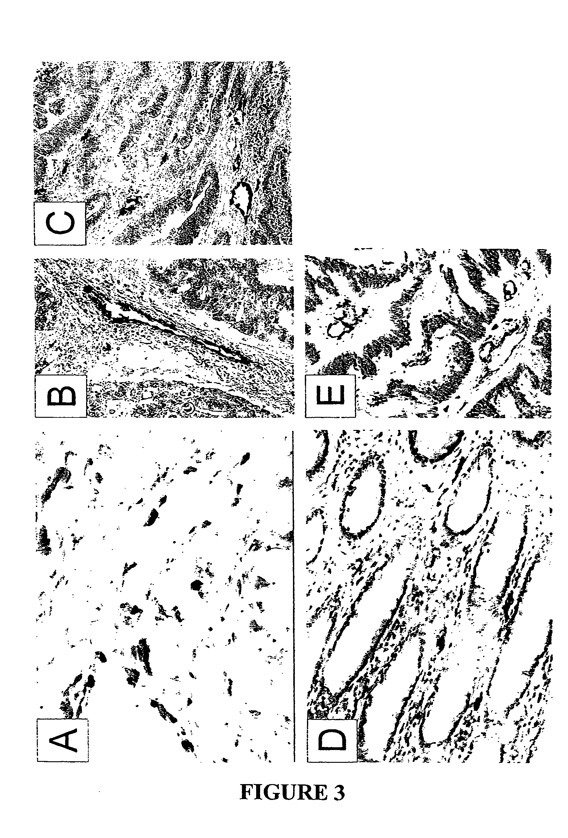 Endothelial cell expression patterns