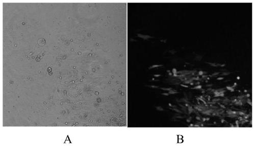 Construction and application of recombinant turkey herpesvirus expressing H7N9 subtype highly pathogenic avian influenza virus HA protein