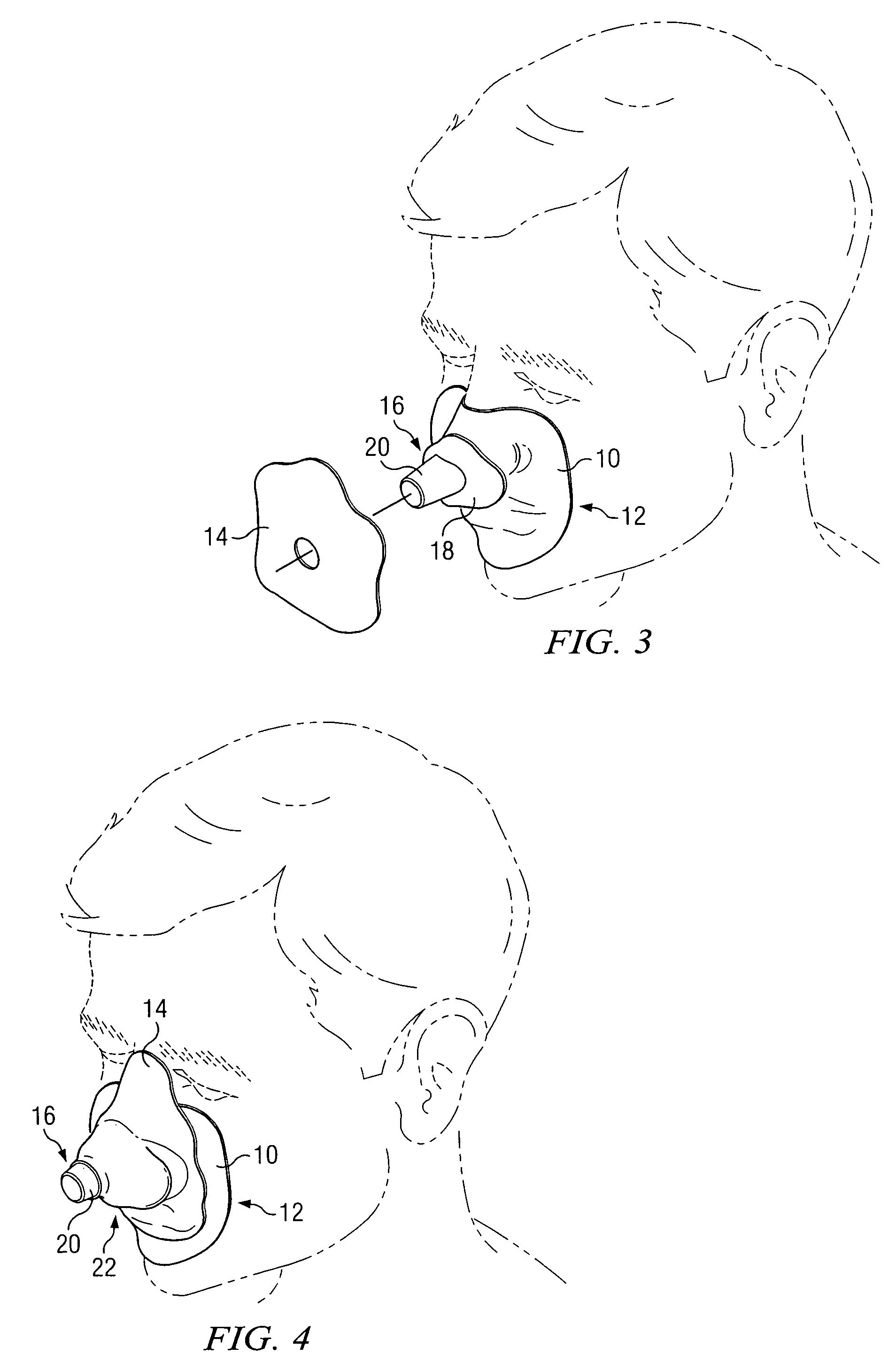 Custom fitted mask configured for coupling to an external gas supply system and method of forming same