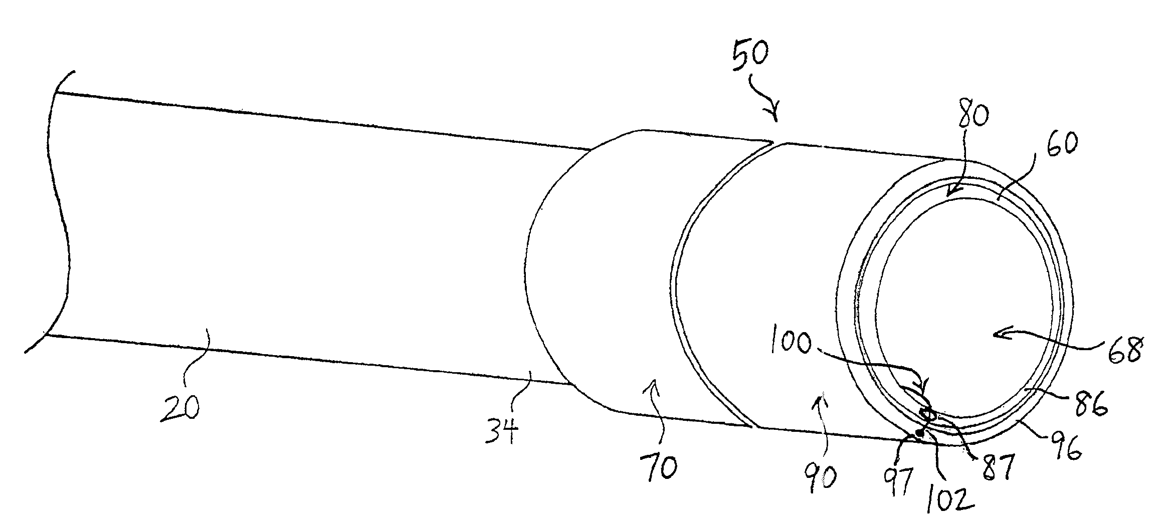 Endoscopic systems and methods for resection of tissue