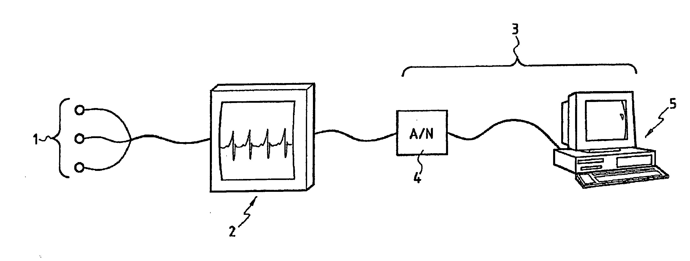 Method For Processing A Series Of Cardiac Rhythm Signals (Rr) And The Use Thereof For Analysing A Cardiac Rhythm Variability, In Particular For Assessing A Patient's Pain Or Stress