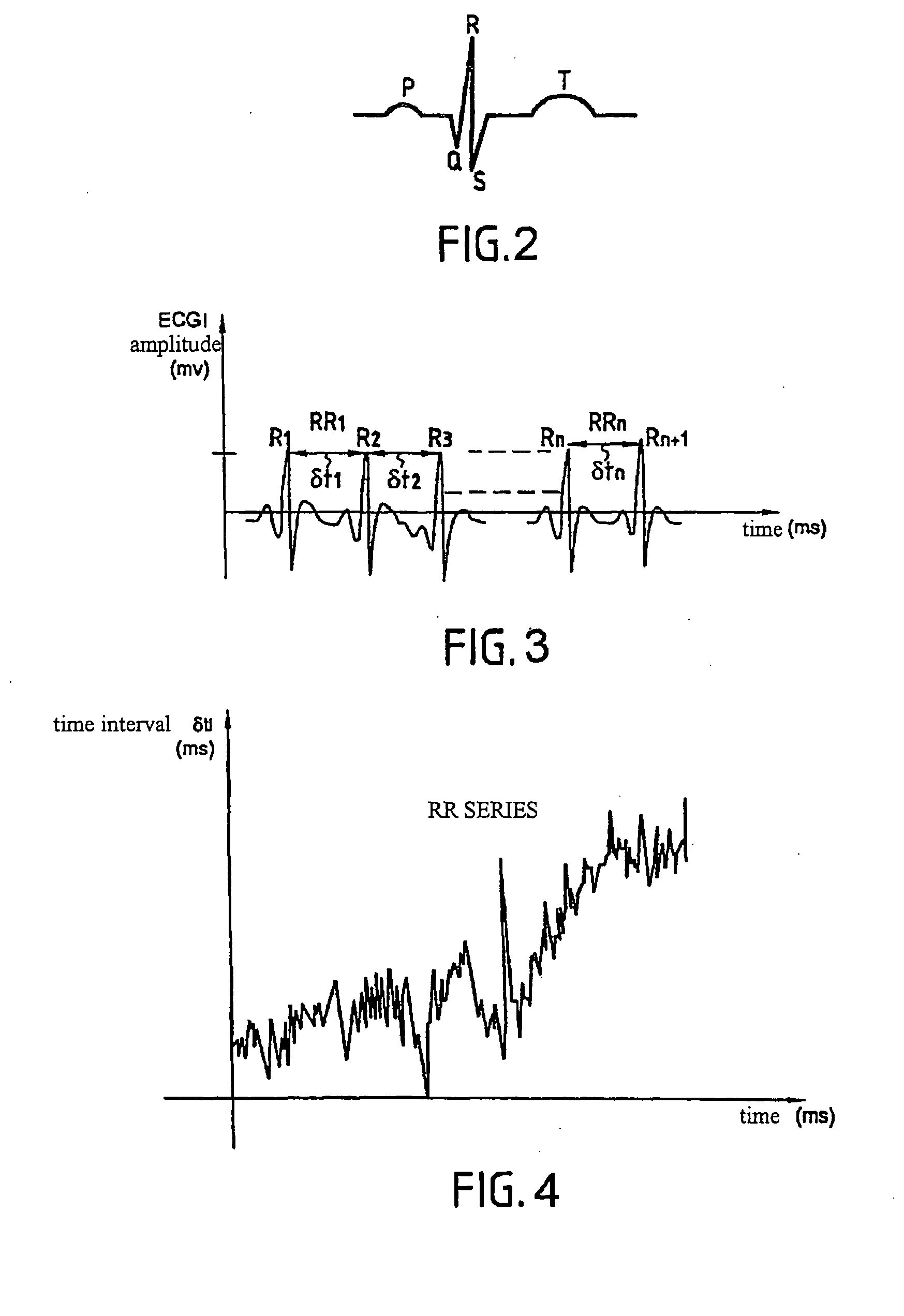 Method For Processing A Series Of Cardiac Rhythm Signals (Rr) And The Use Thereof For Analysing A Cardiac Rhythm Variability, In Particular For Assessing A Patient's Pain Or Stress