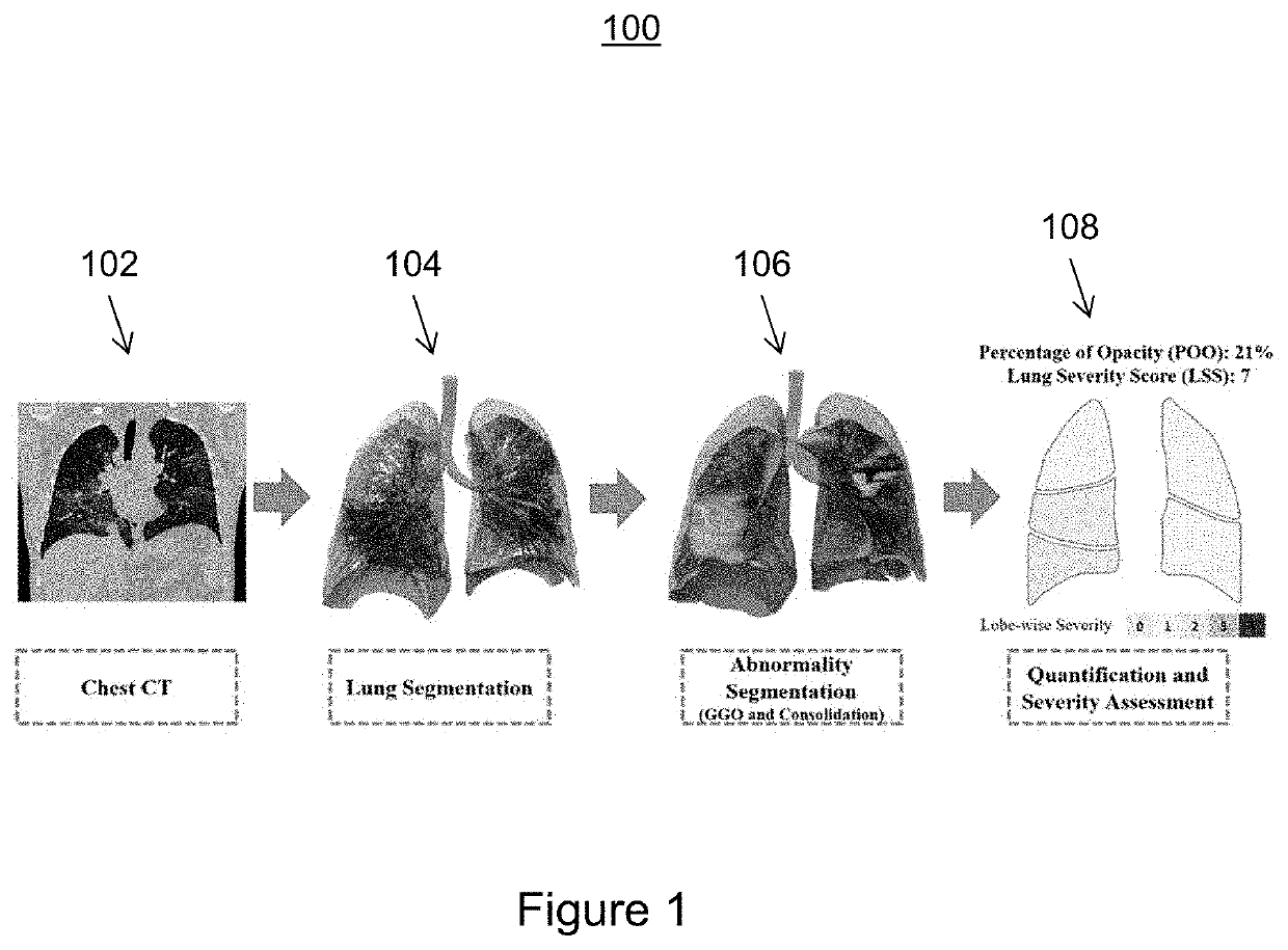 Assessment of Abnormality Regions Associated with a Disease from Chest CT Images