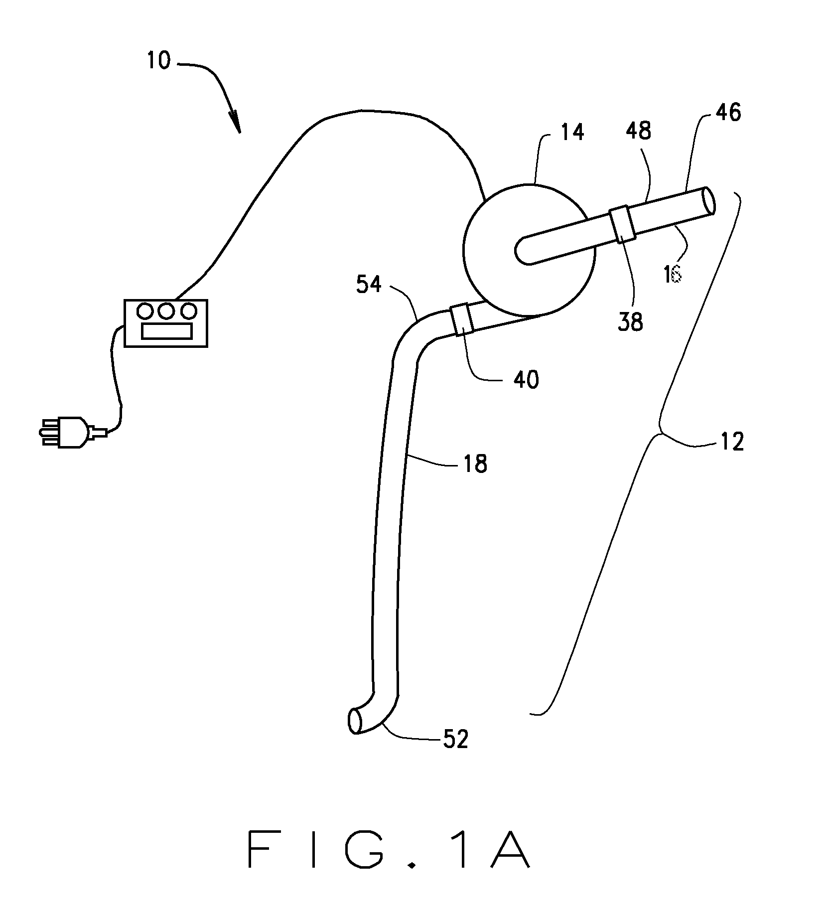 System and method to increase the overall diameter of veins and arteries