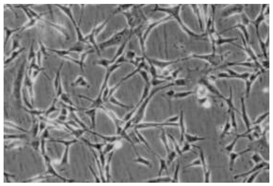 Method for three-dimensional culture of fibrous ring derived stem cells based on Collagel gel bracket method