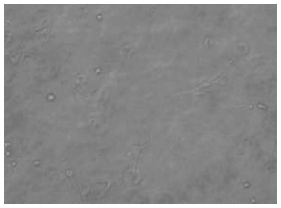 Method for three-dimensional culture of fibrous ring derived stem cells based on Collagel gel bracket method