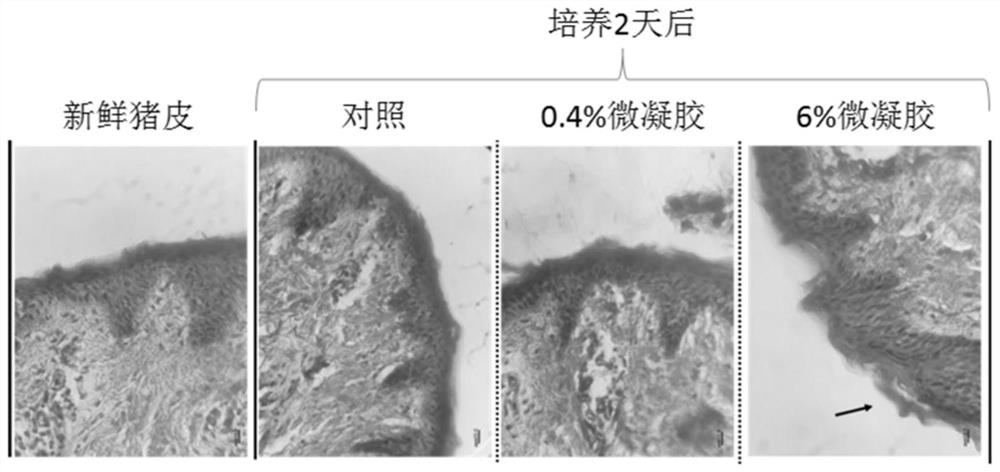 Application of polyethyleneimine-cellulose composite gel