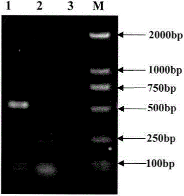 PCR detection kit and detection method for Streptococcus equi