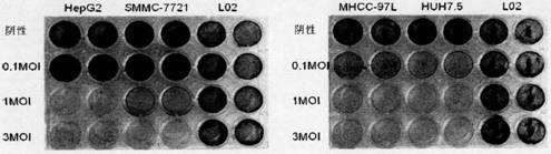 Preparation method and application of recombinant oncolytic influenza virus