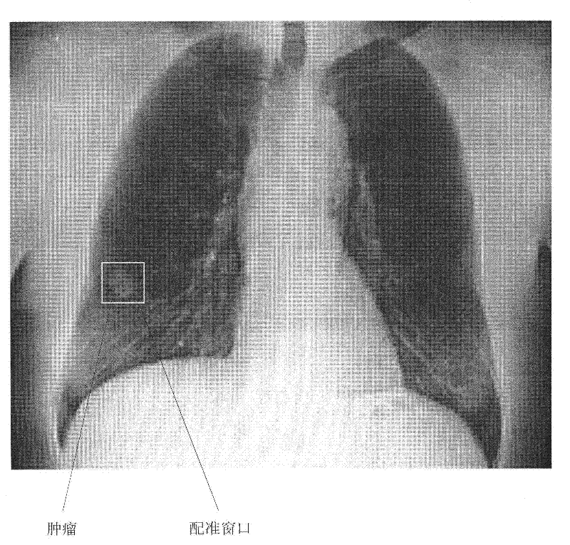 Method and system for positioning soft tissue lesion based on dual-energy X-ray images