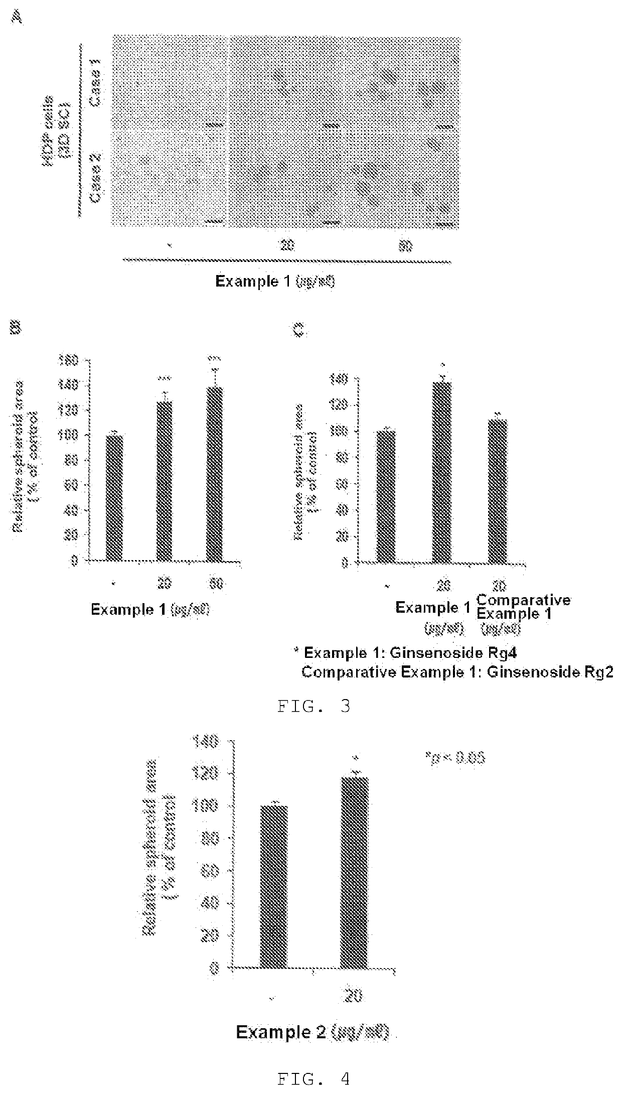 Pharmaceutical composition for preventing hair loss or promoting hair growth, comprising ginsenoside rg4 or mixture (rgx 365) of ginsenosides rg2, rg4, rg6, and rh1 as active ingredient