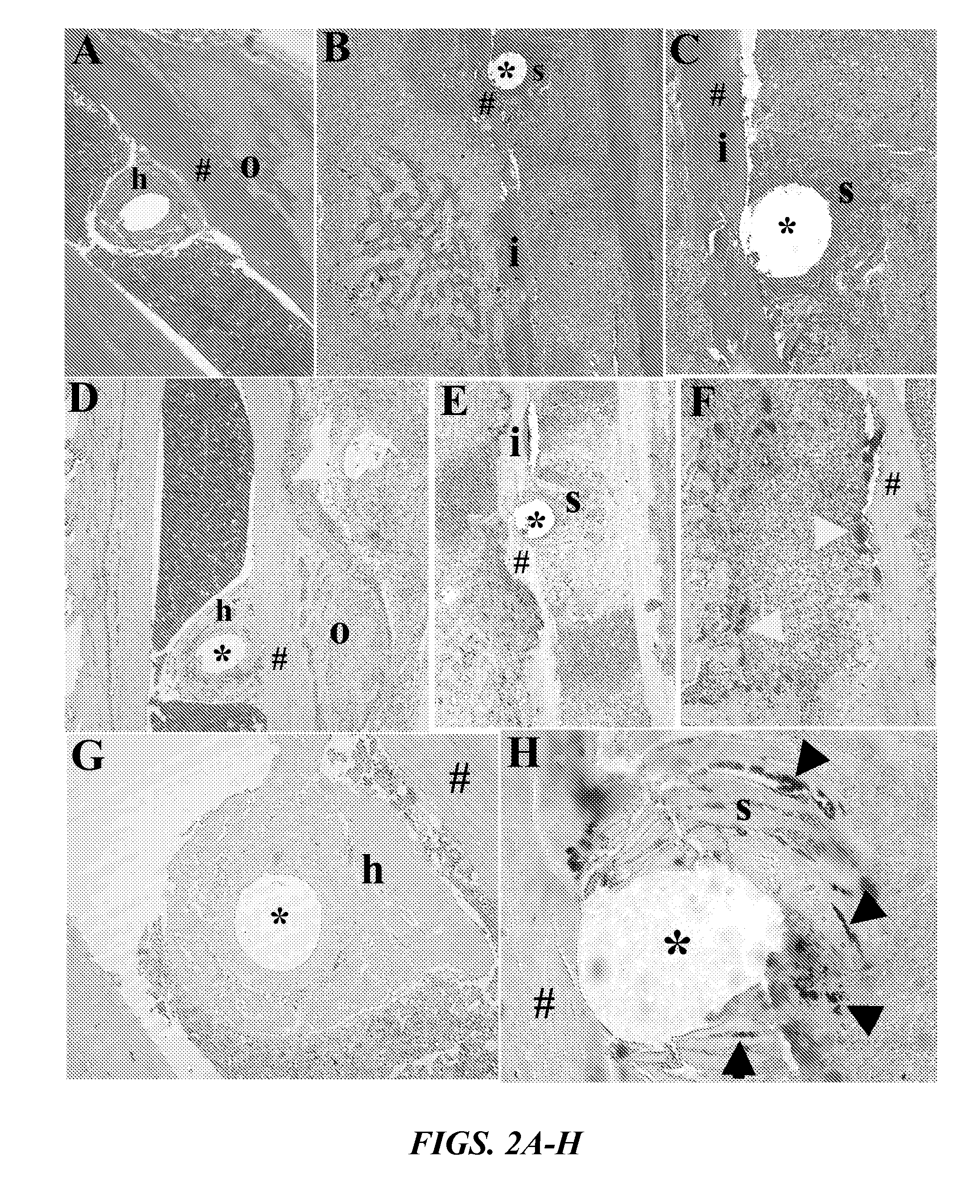 Anti-glucosaminidase passive immunization for staphylococcus aureus infections