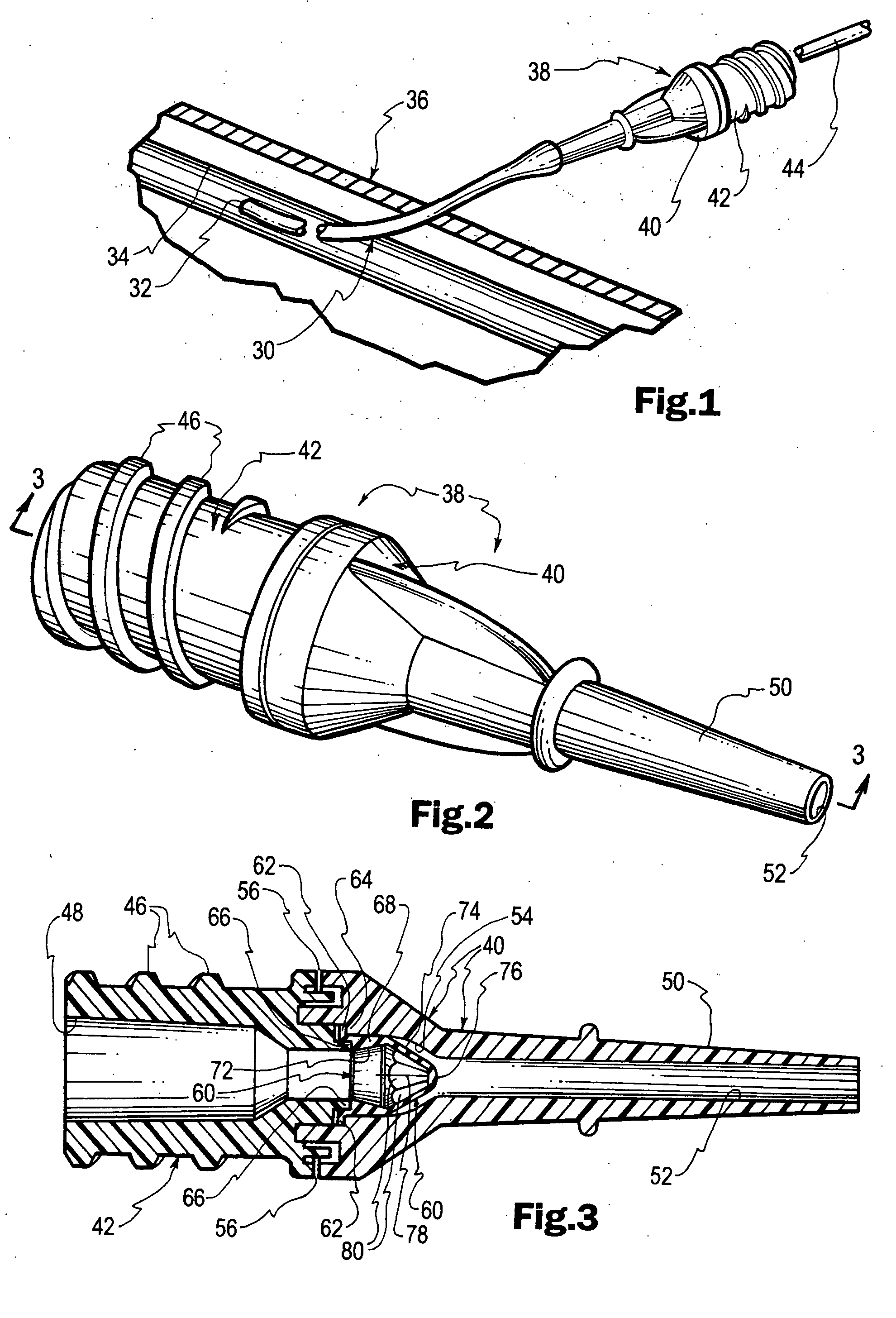 Outdwelling slit valves and assemblies for medical liquid flow through a cannula and related methods