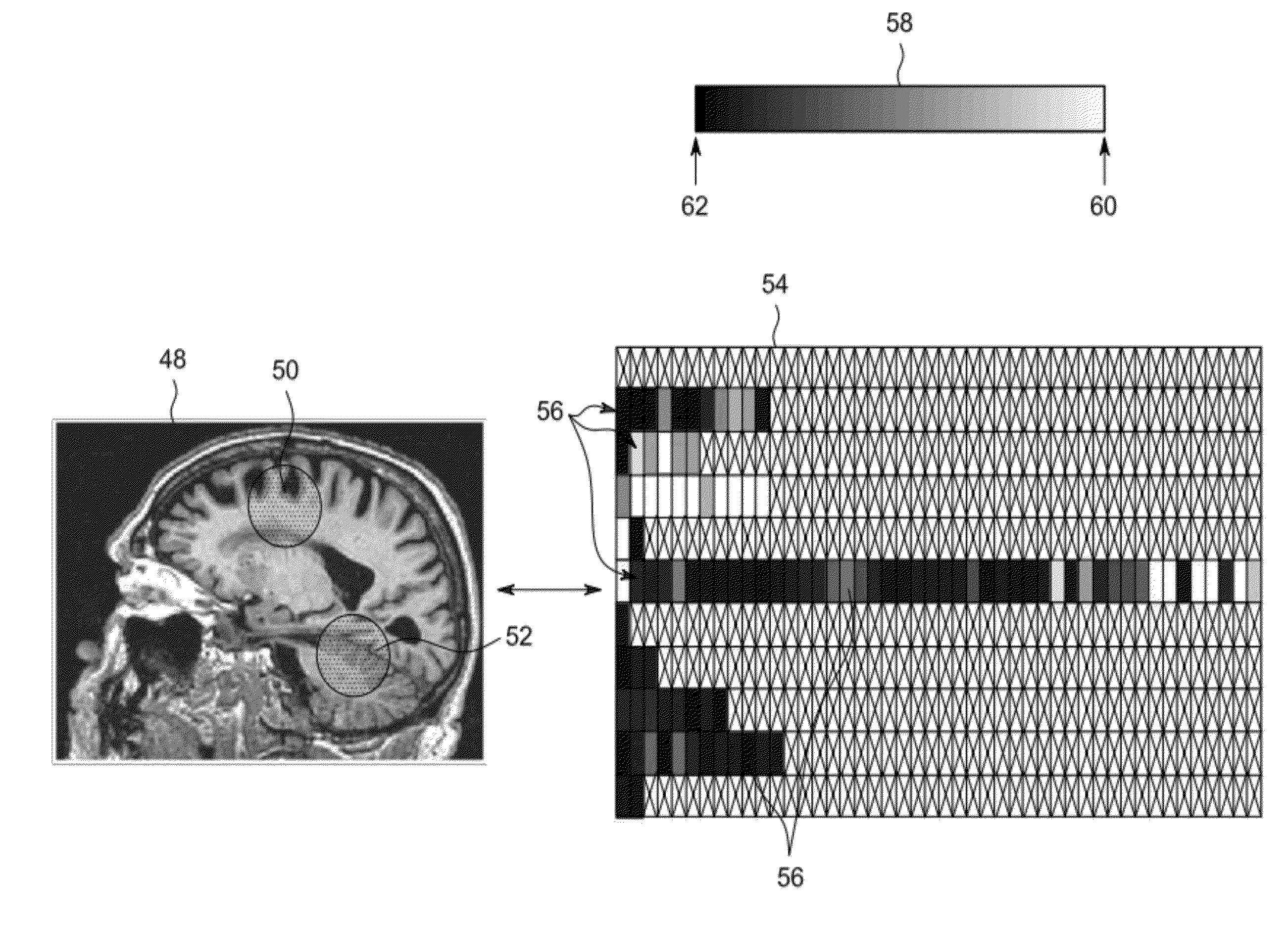 System and method for analyzing and visualizing local clinical features