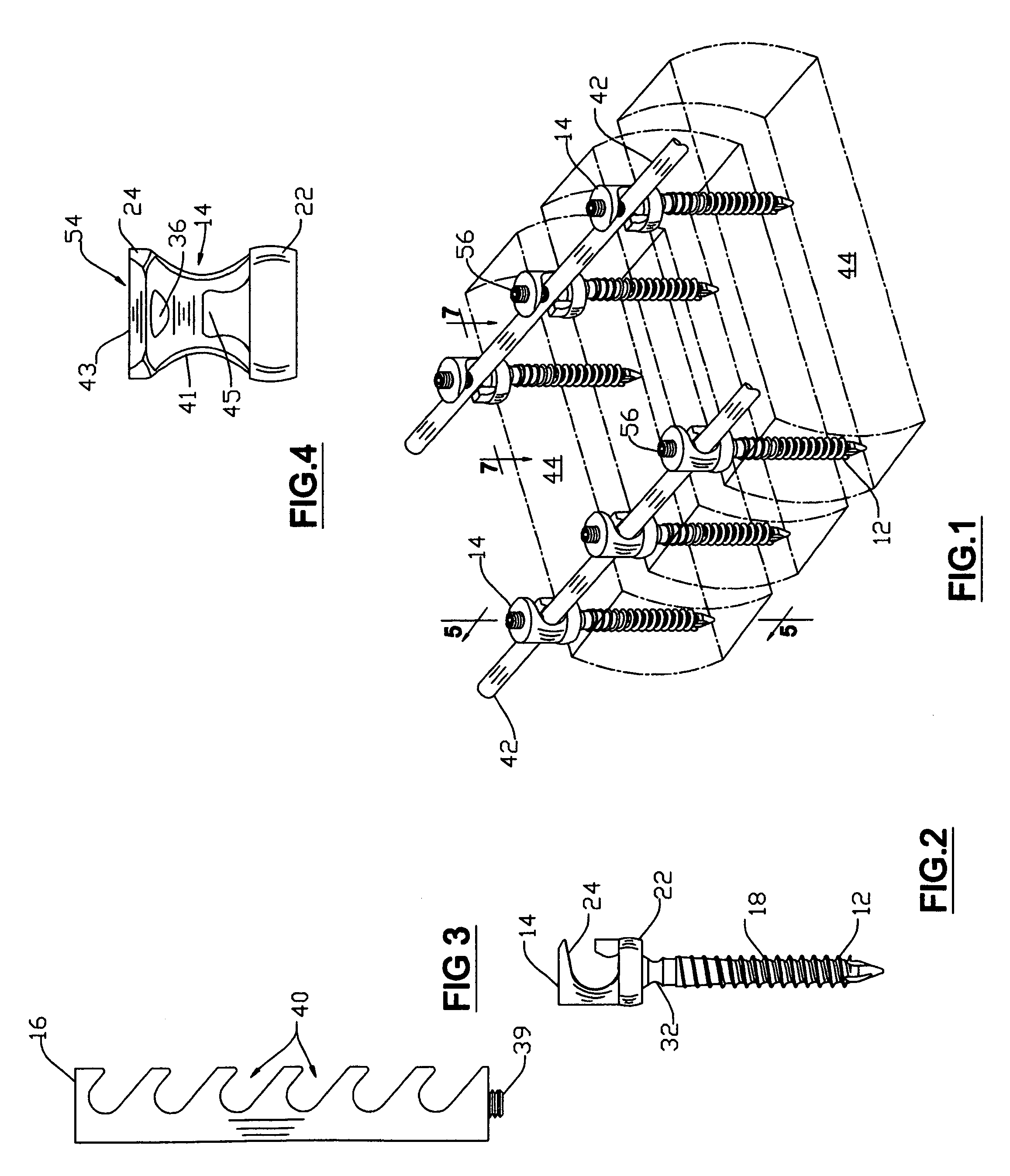 Apparatus ans method for aligning and/or stabilizing the spine