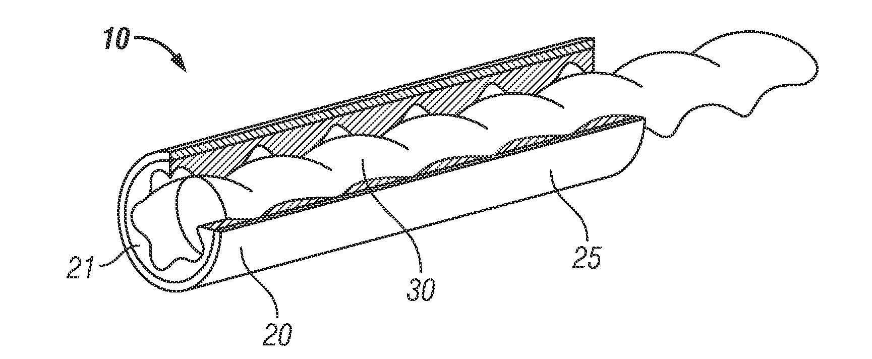 Reinforced Stators and Fabrication Methods