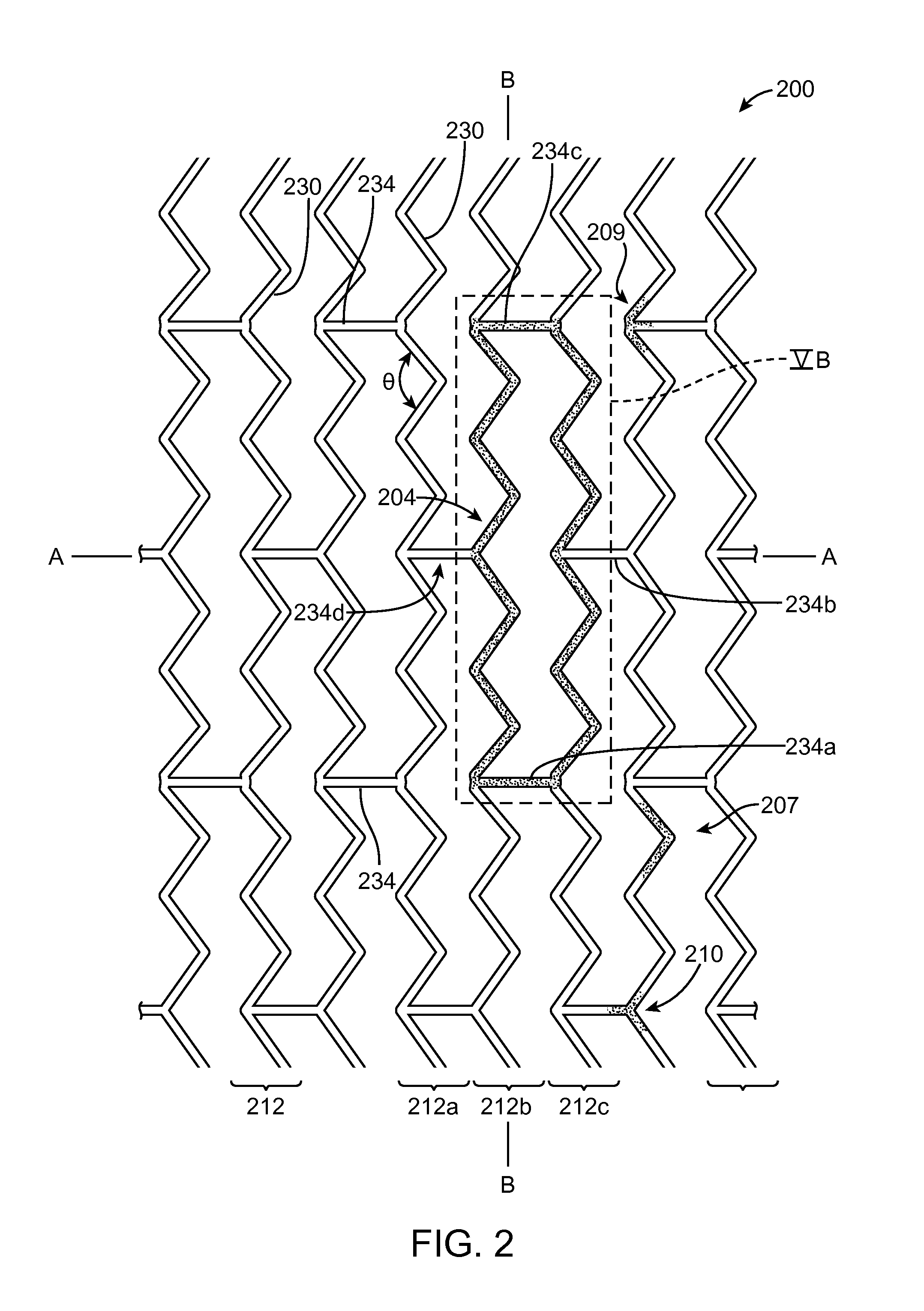 Polymer scaffolds for peripheral vessels