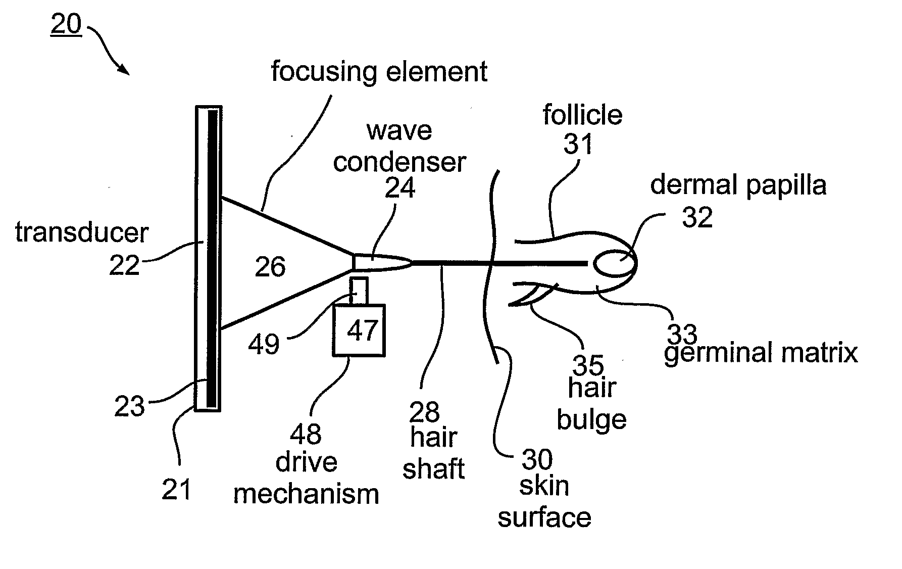 Method and device for removing hair