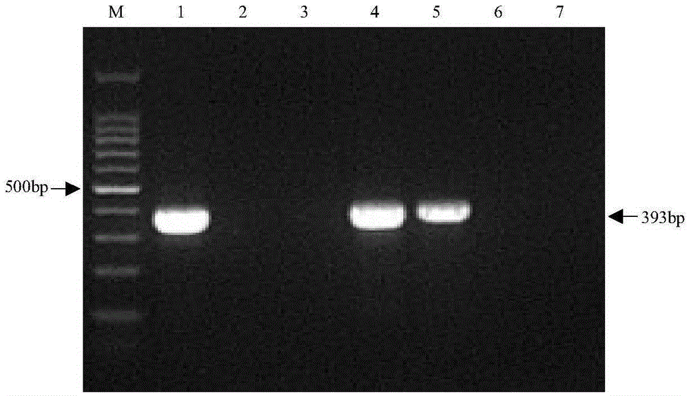 Narcissus retrovirus nested RT-PCR detection kit and its detection method
