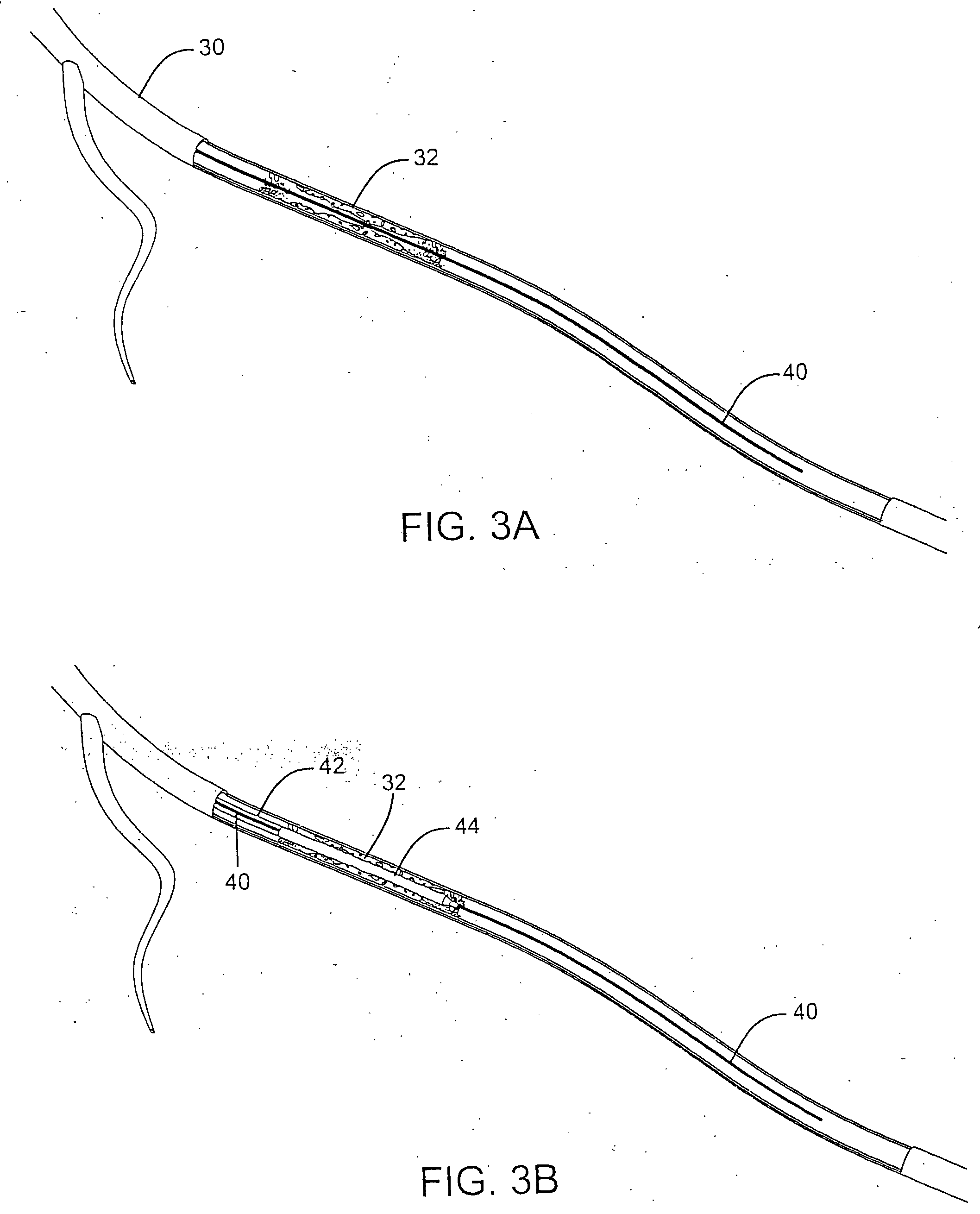 Stent delivery system with diameter adaptive restraint
