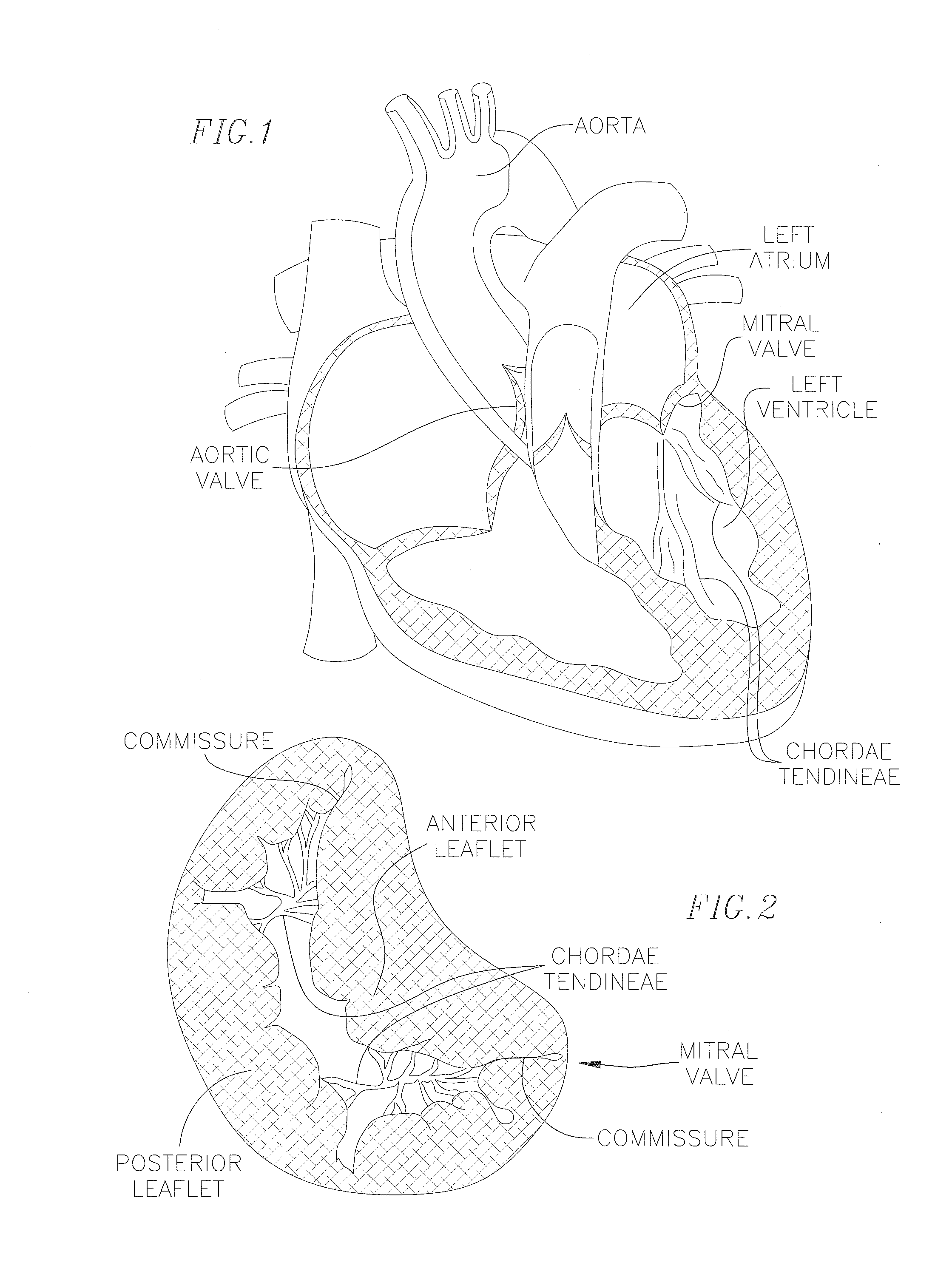 Covering and assembly method for transcatheter valve
