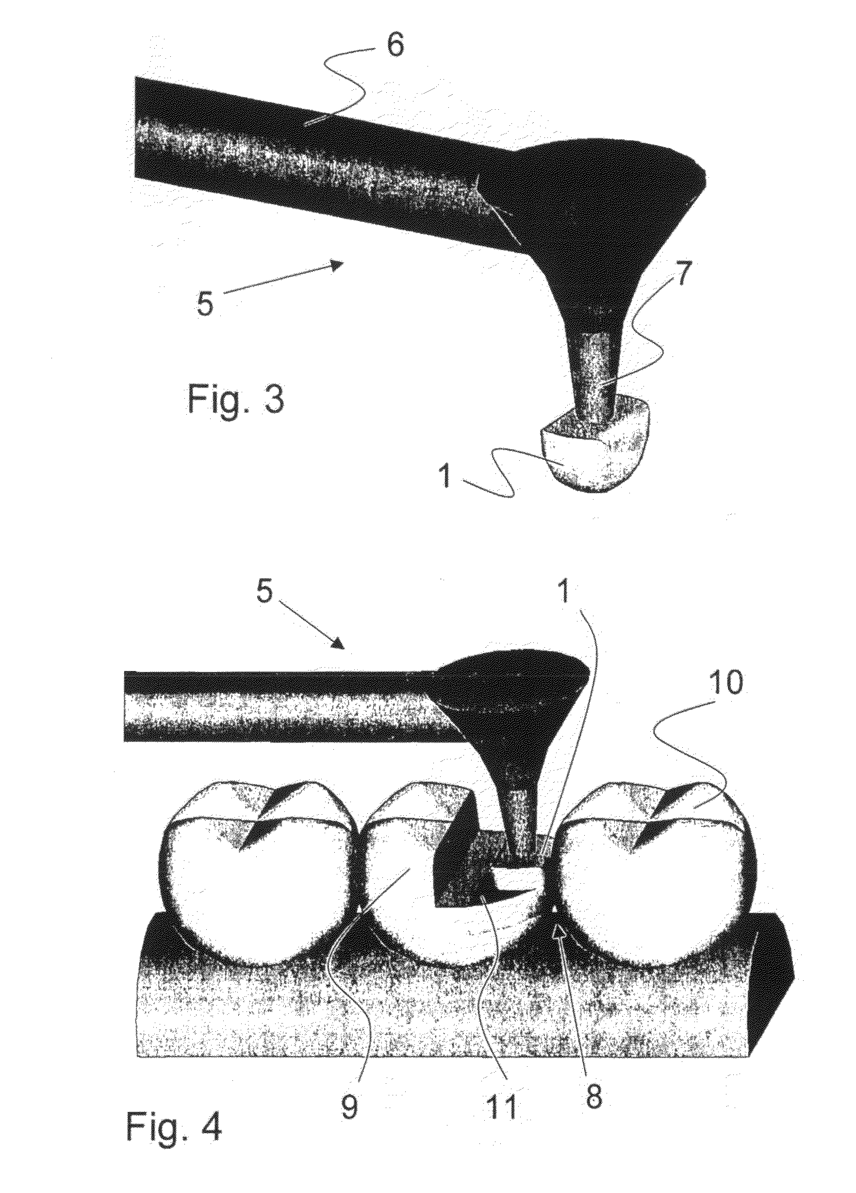 Insertion, Devices, Methods and System for Use in Dentistry