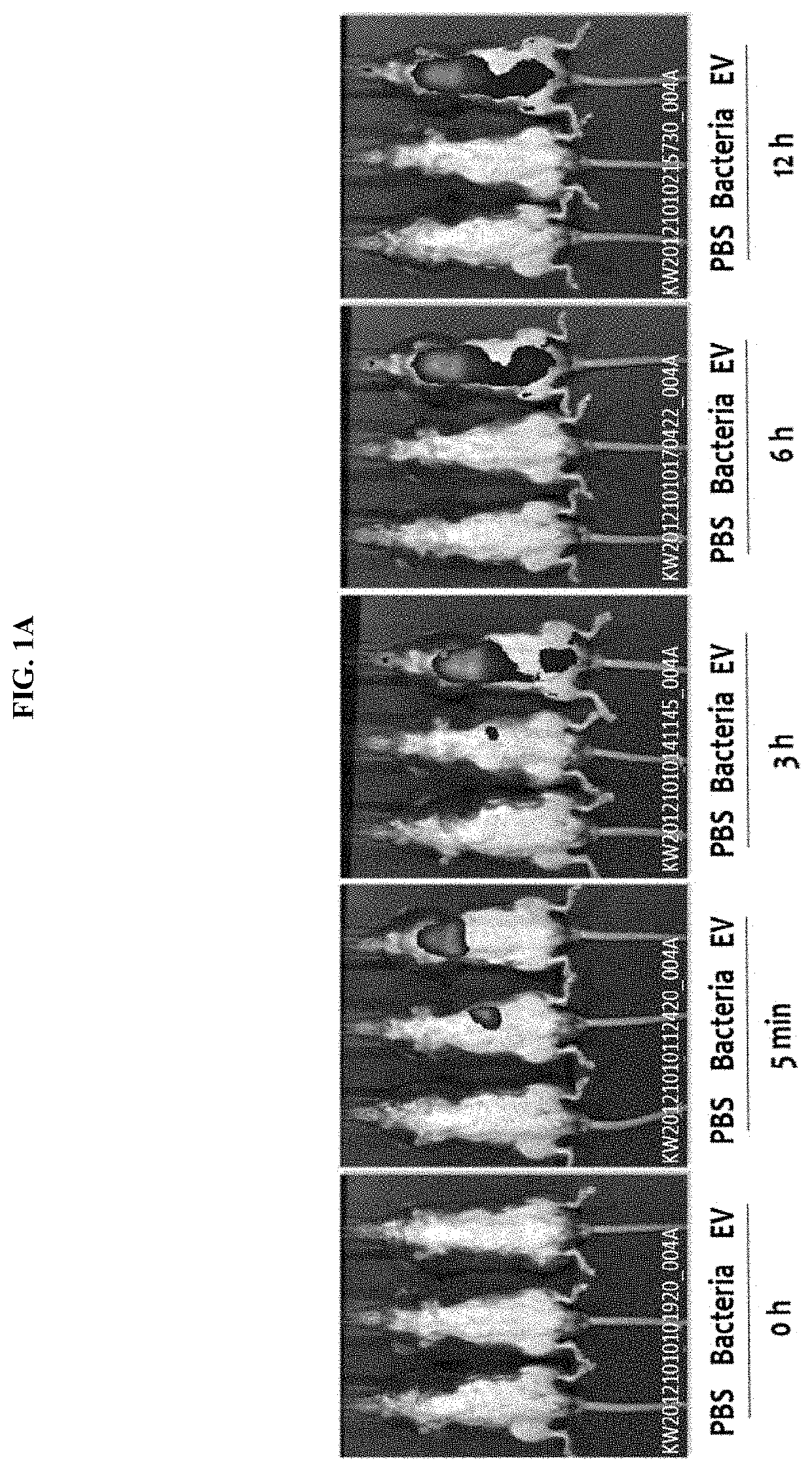 Nanovesicles derived from blautia bacteria and use thereof