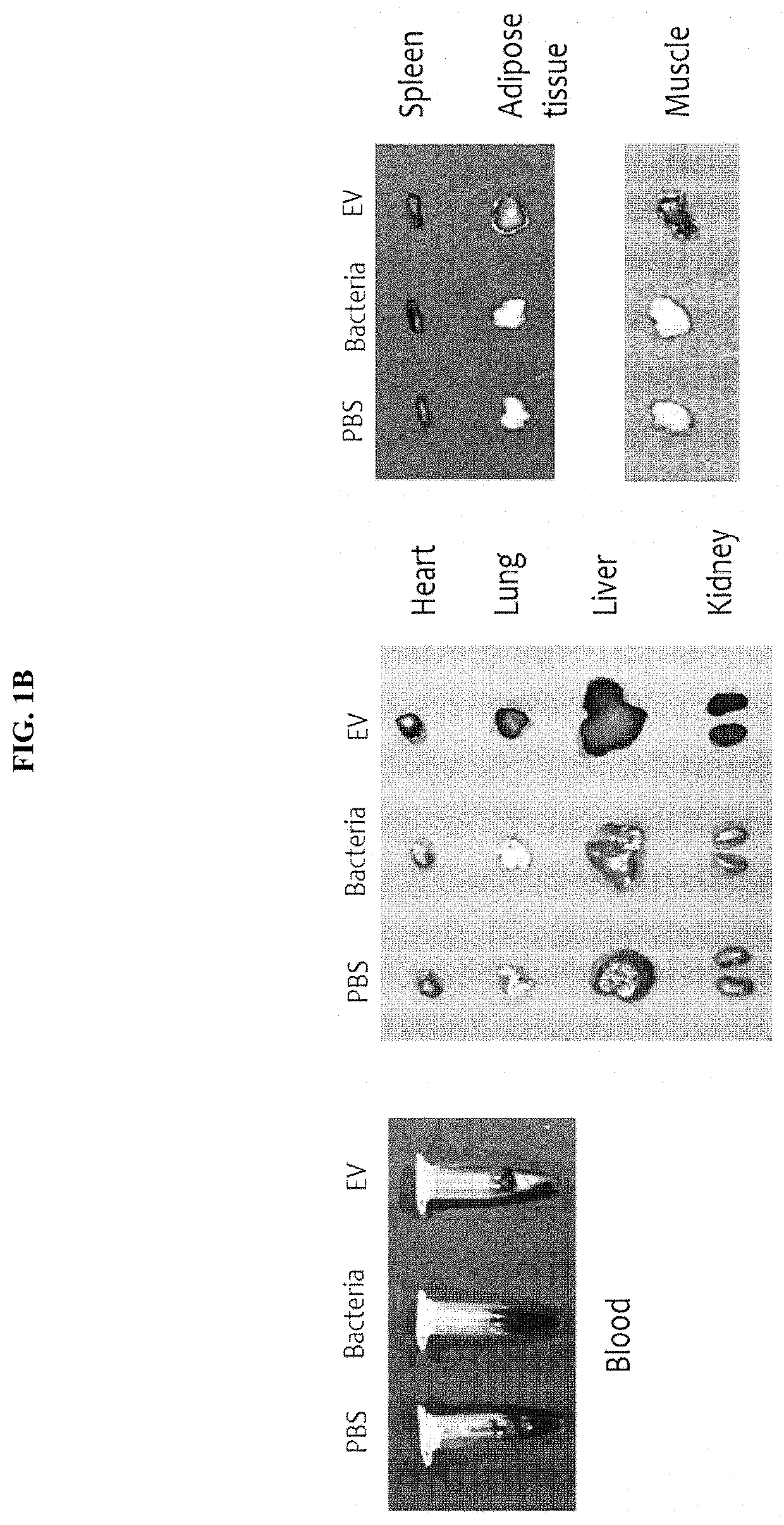 Nanovesicles derived from blautia bacteria and use thereof