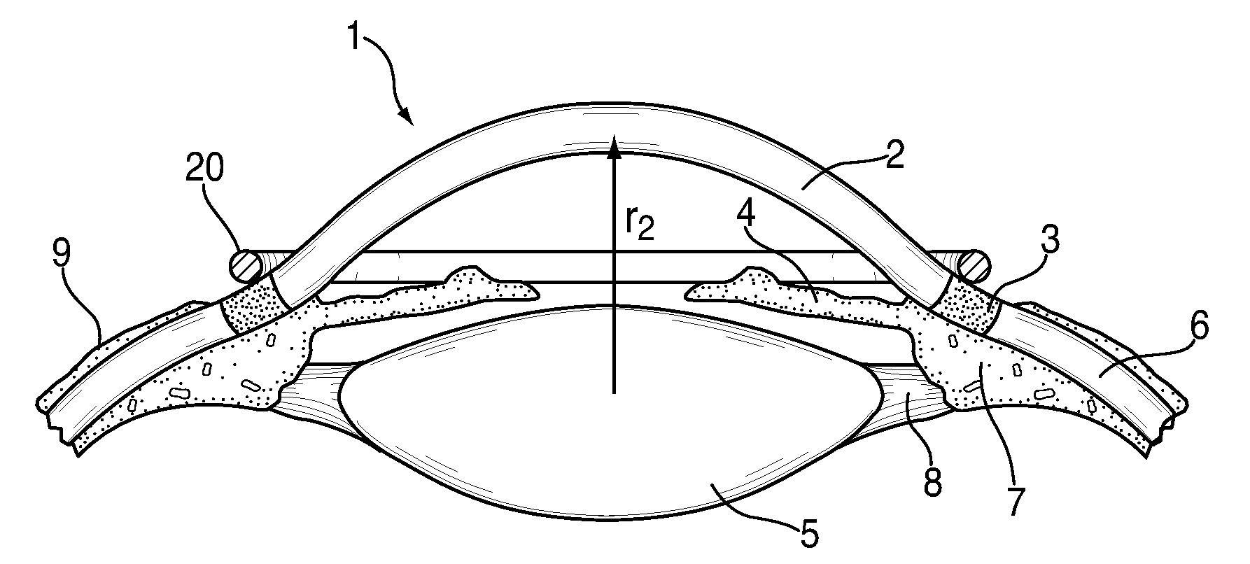 System and device for correcting hyperopia, myopia and presbyopia