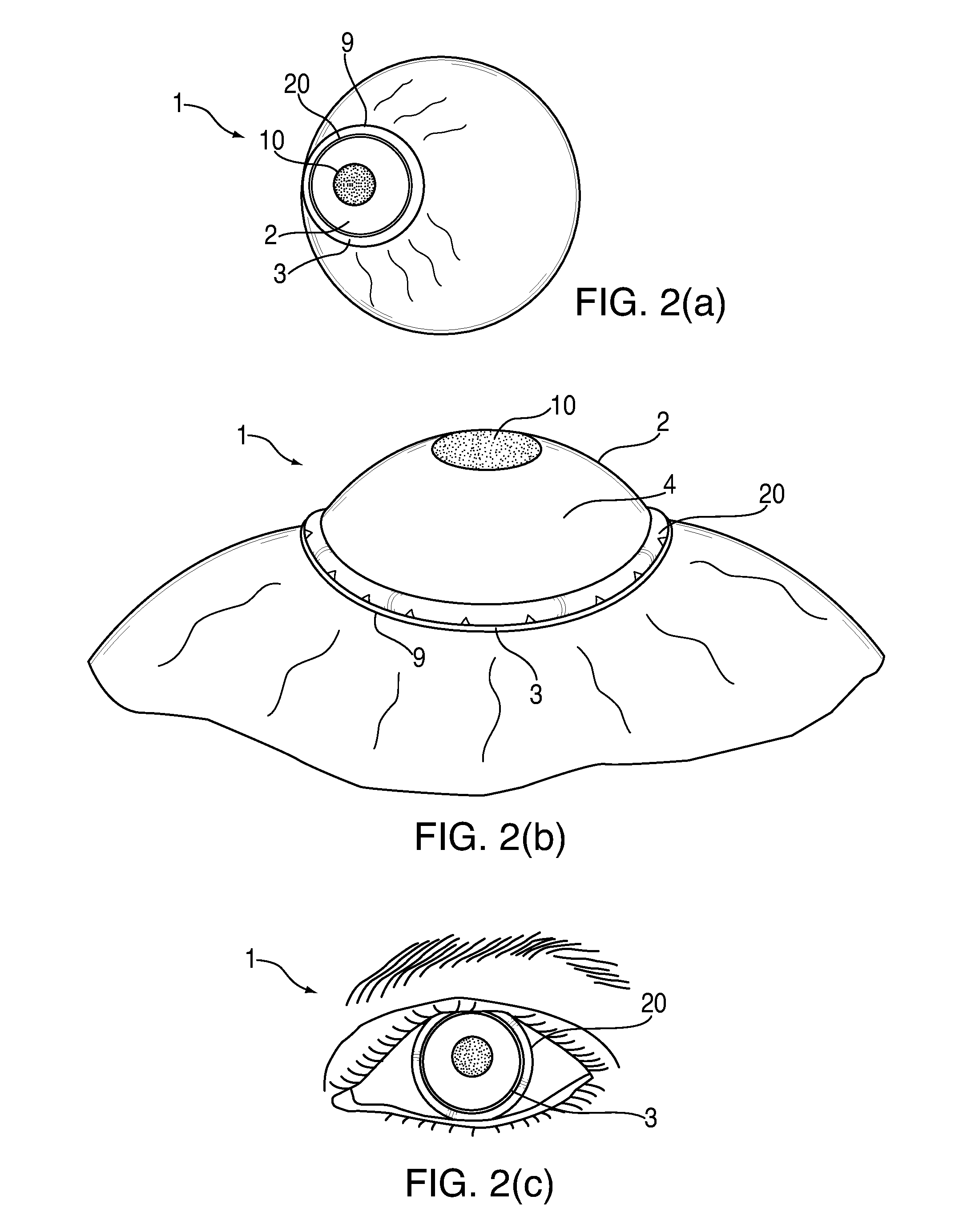 System and device for correcting hyperopia, myopia and presbyopia