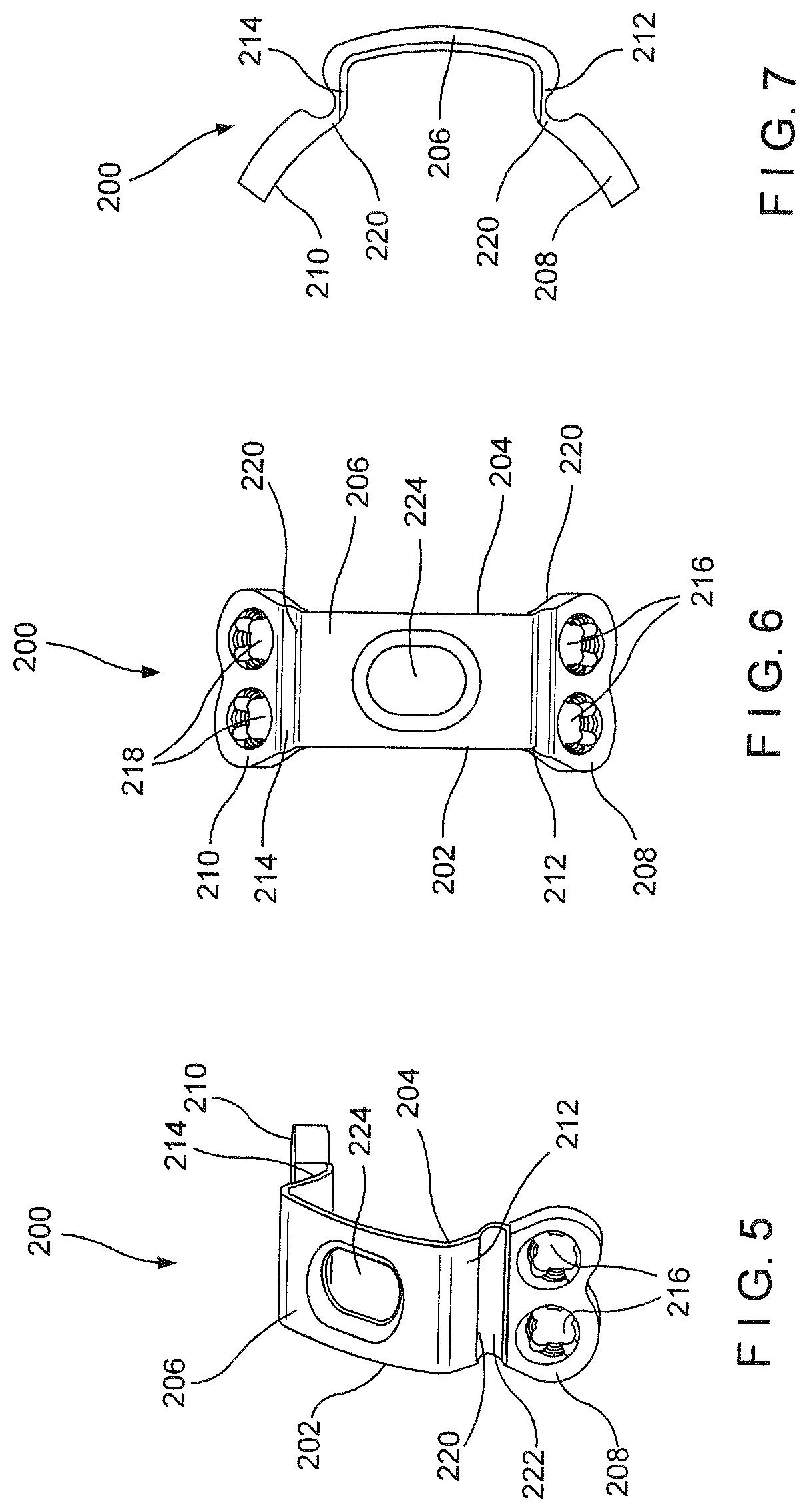 Proximal femur hook plate