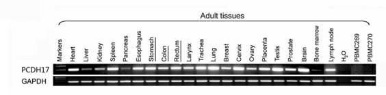 Application of protocadherin (PCDH) 17 genes