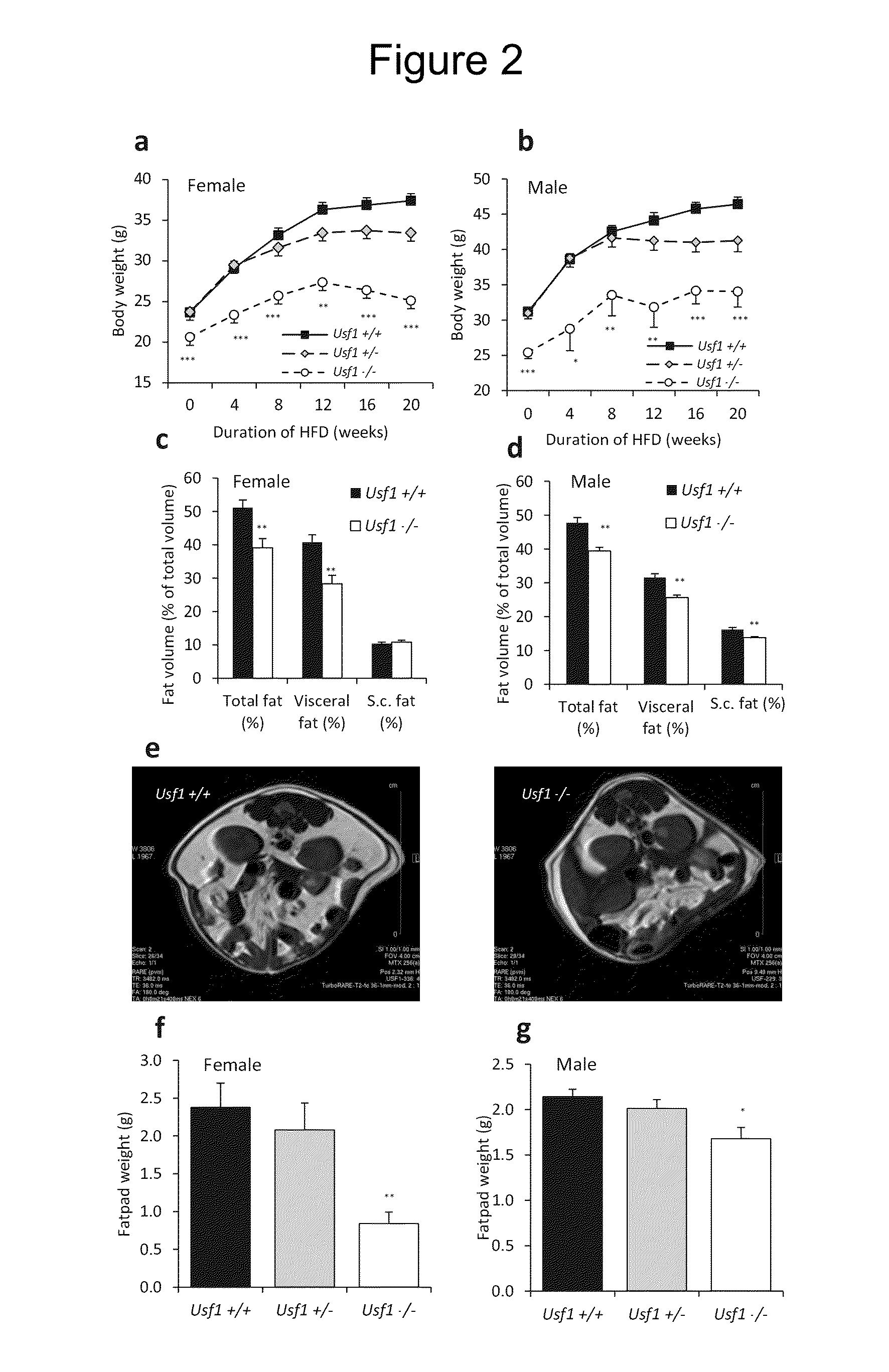 Methods to screen compounds for regulating USF1 activity and methods and compounds to treat cardiometabolic and lipid pathologies