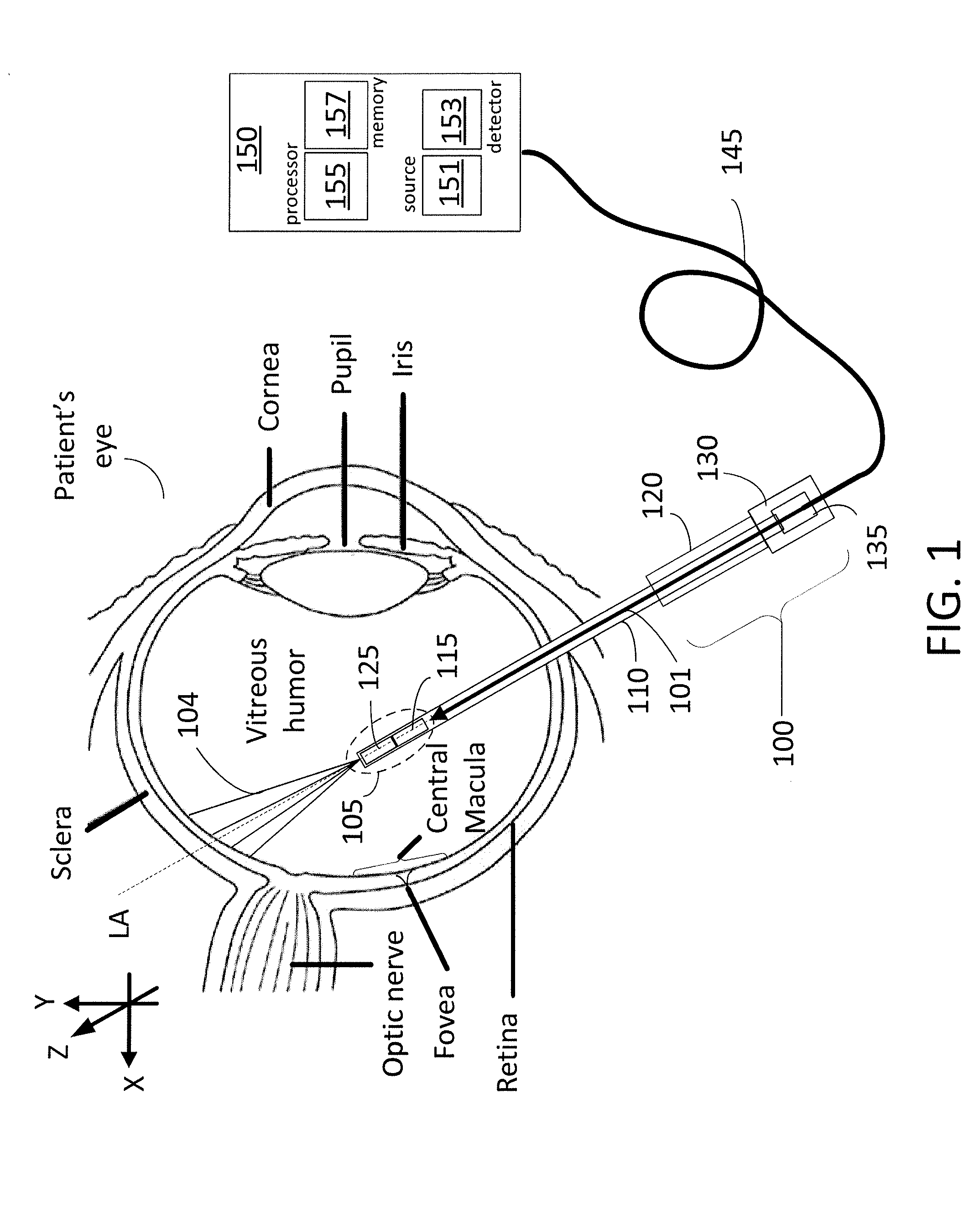 Anamorphic Lens for Rotational Scanning Laser Probe