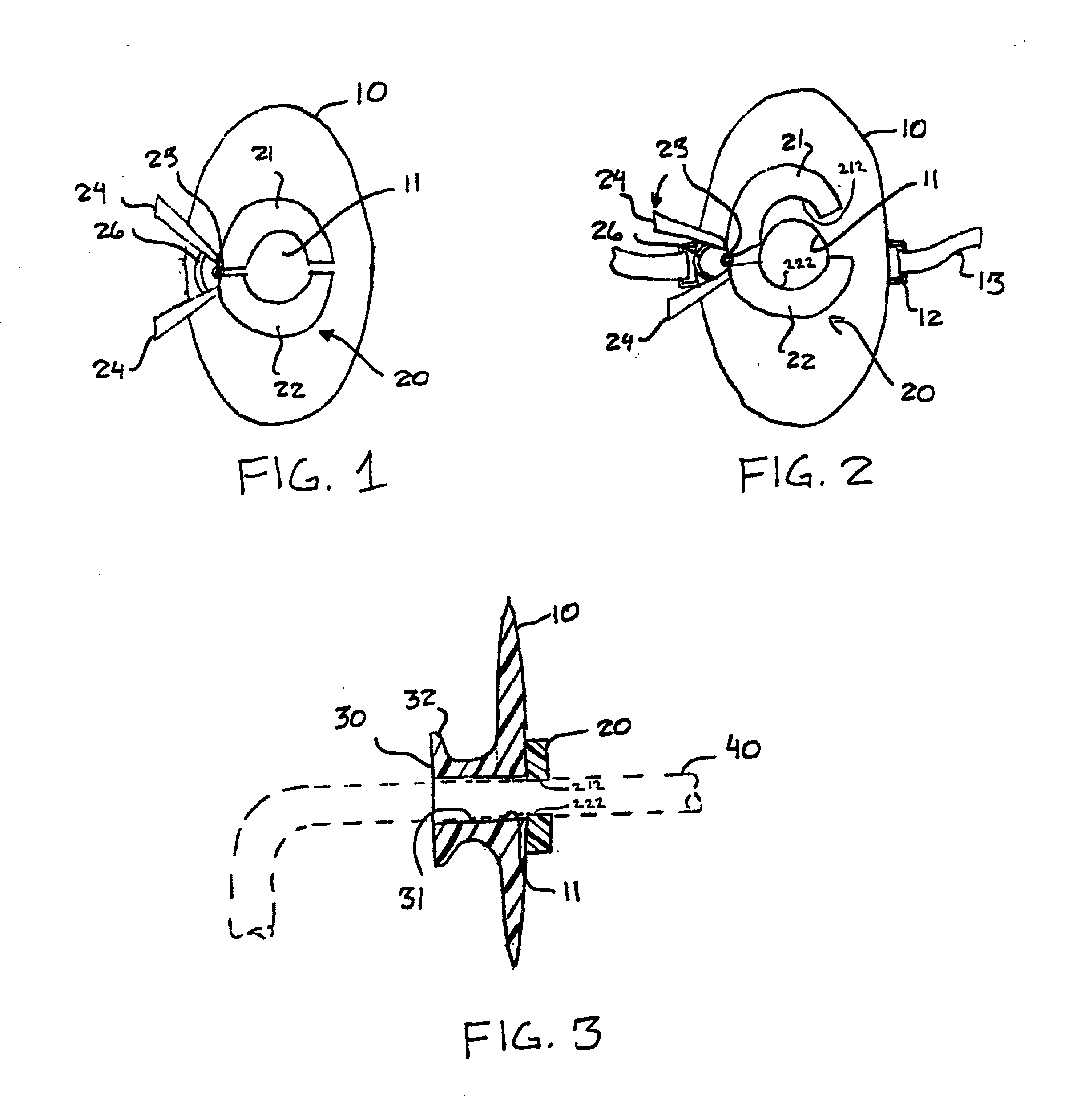 Securing device for an endotracheal tube