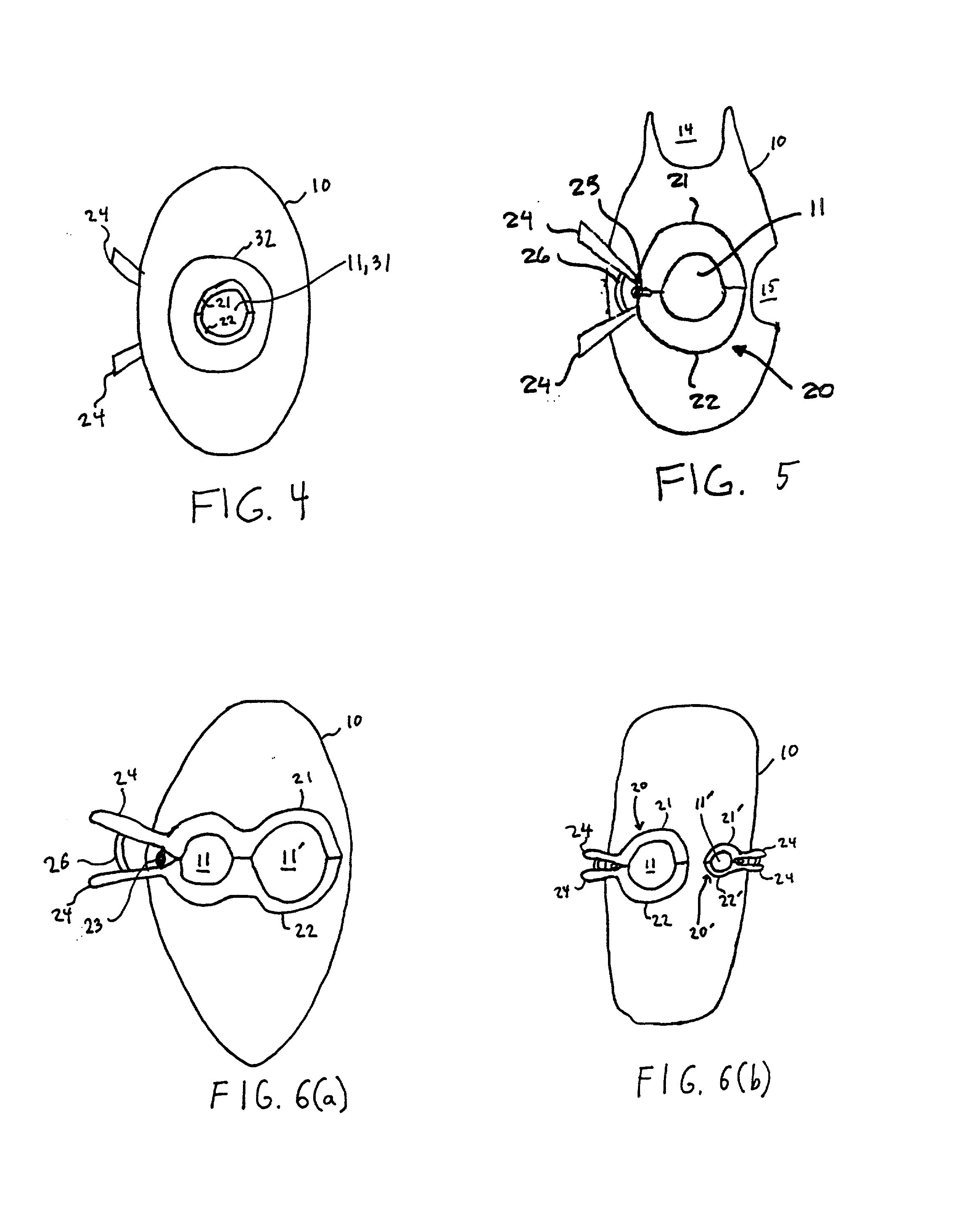 Securing device for an endotracheal tube