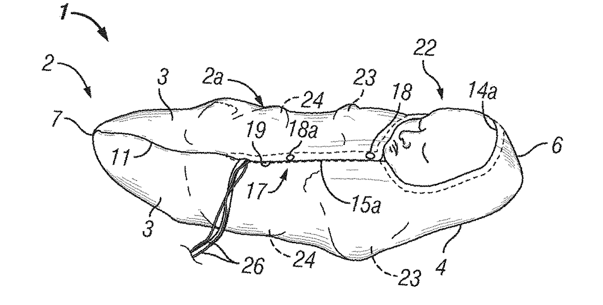 Infant joint compression device and method