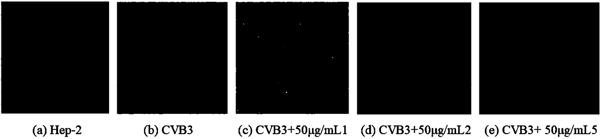 Application of amino acid ester compounds in preparation of anti-CVB3 (anti-coxsackie B virus 3) drugs