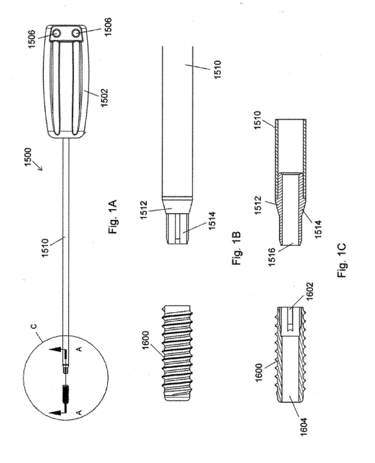 Implant placement systems, devices and methods