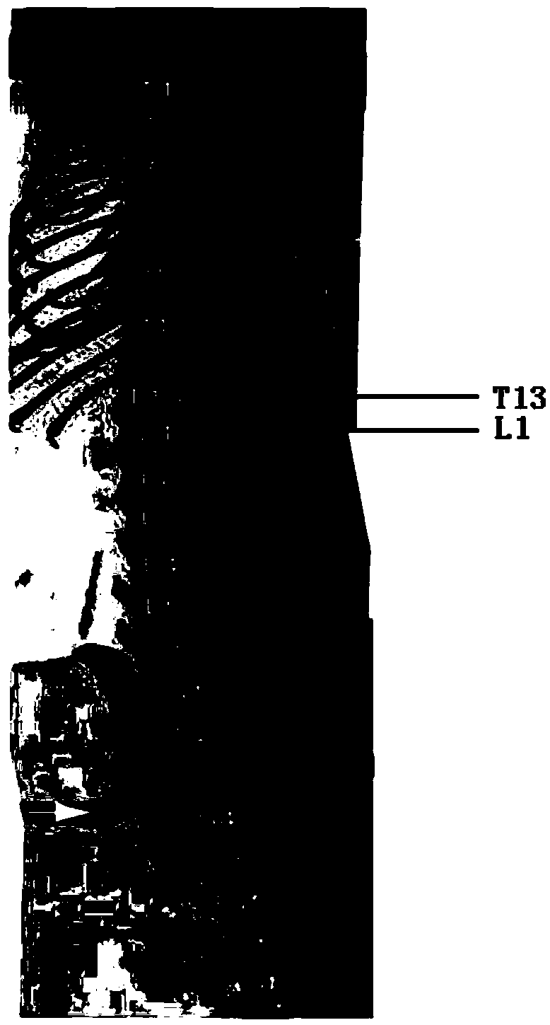 Mouse model for studying axon regeneration of spinal anterior horn motor neurons