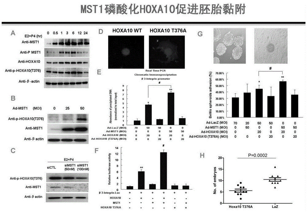 Method for detecting endometrial receptivity through MST1 and phosphorylated MST1