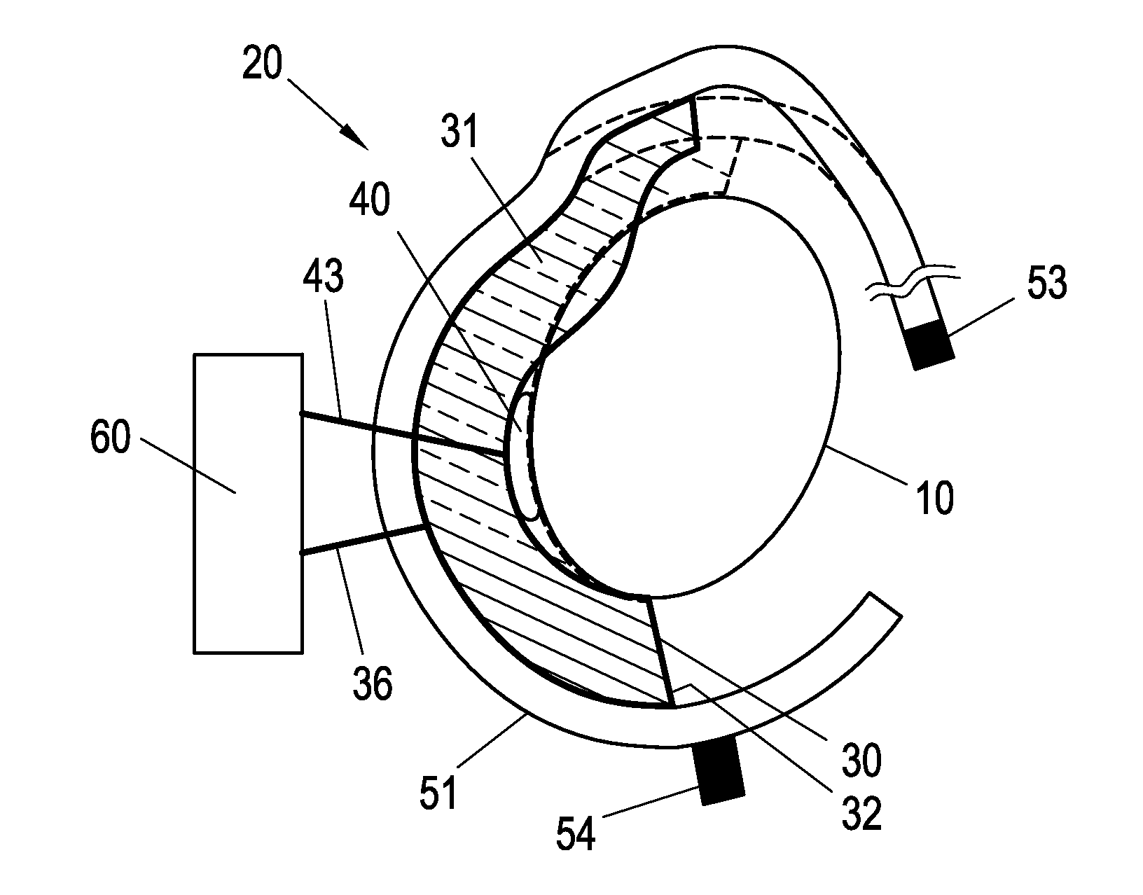 Blood Pressure Measuring Device and Method for Measuring the Blood Pressure of a Living Being