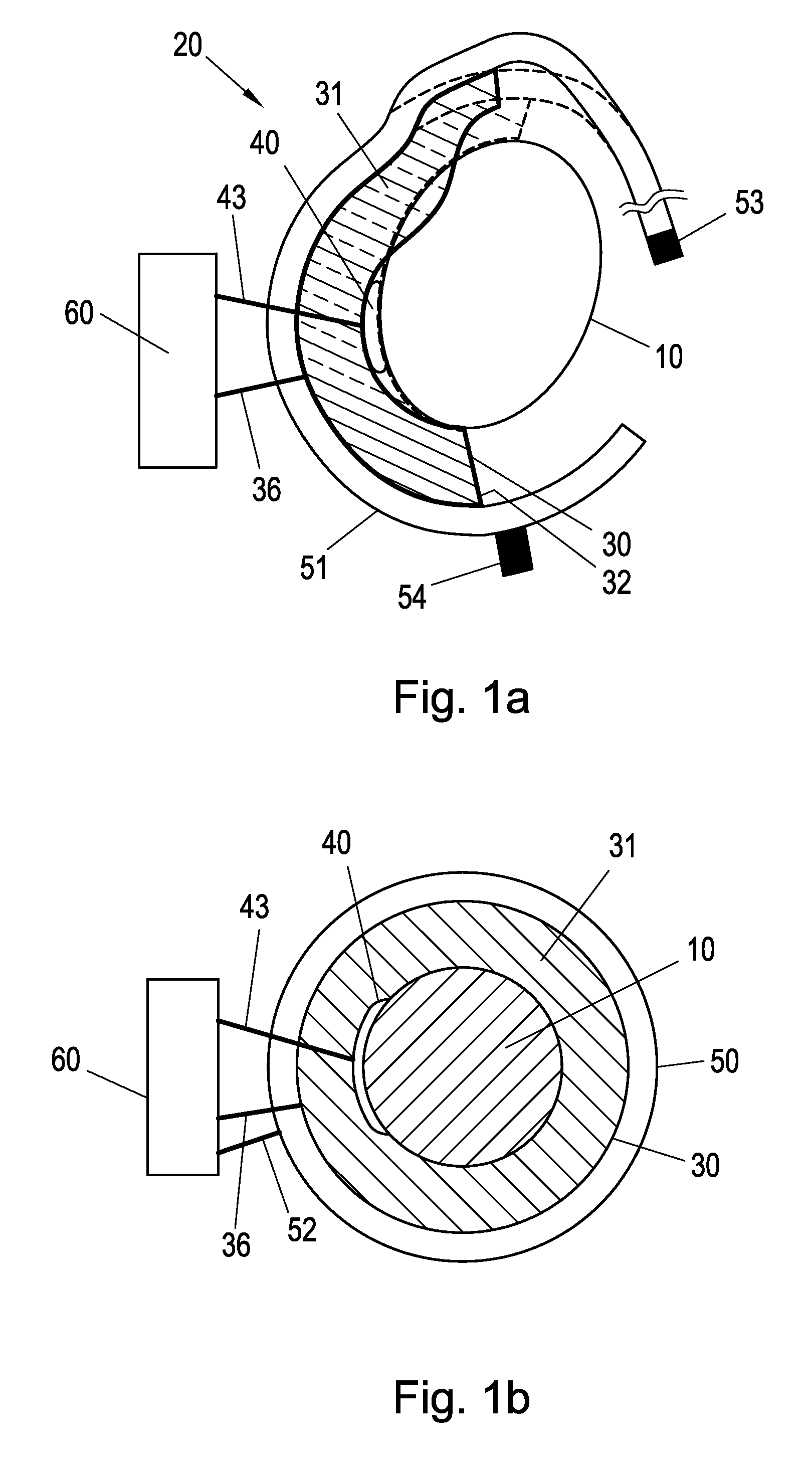 Blood Pressure Measuring Device and Method for Measuring the Blood Pressure of a Living Being