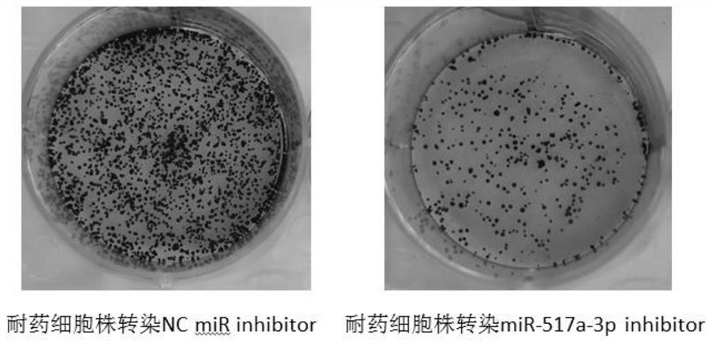 MiR-517a-3p related to cisplatin resistance of tumor cells and application of miR-517a-3p