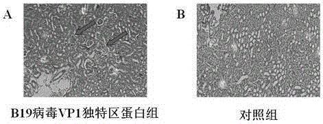 The application of b19 virus vp1 unique region protein to construct viral nephropathy model