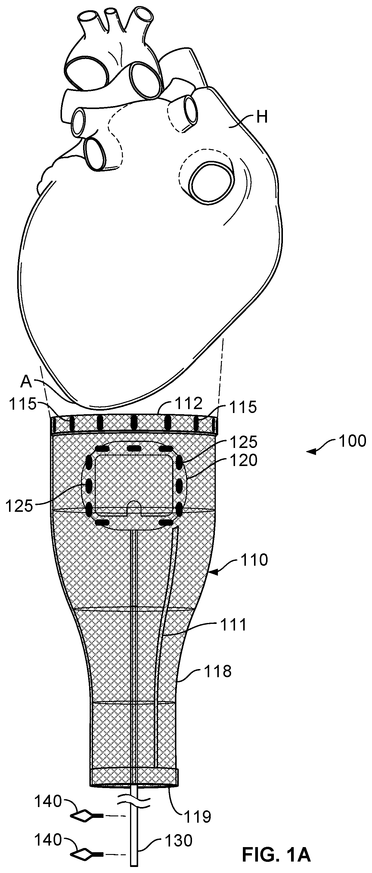 Cardiac treatment system and method