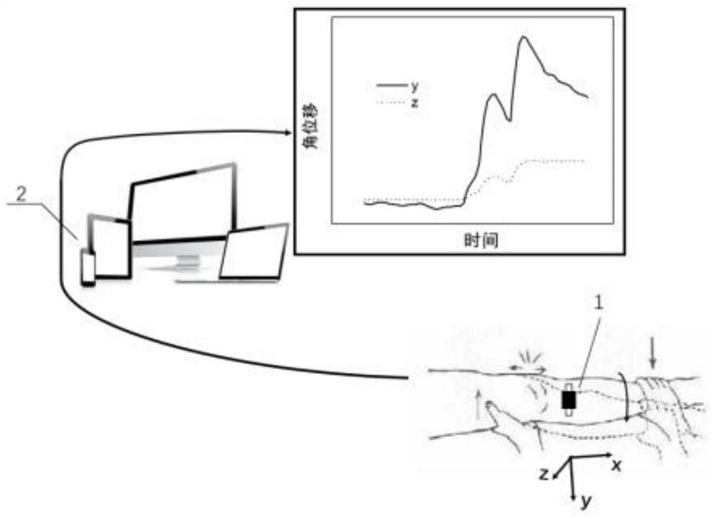 Knee joint collateral ligament injury detection device