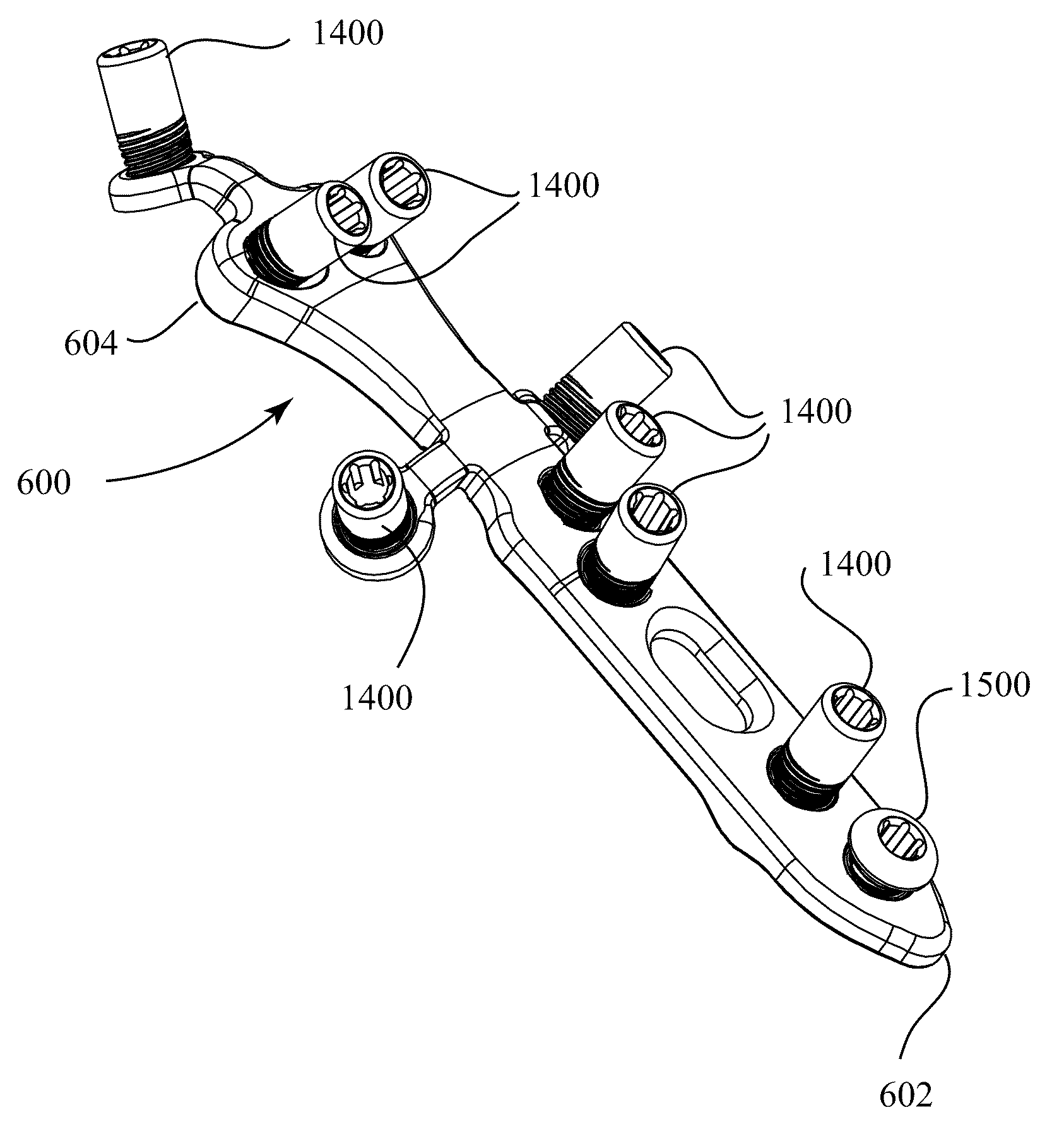 Fracture fixation plate for the olecranon of the proximal ulna