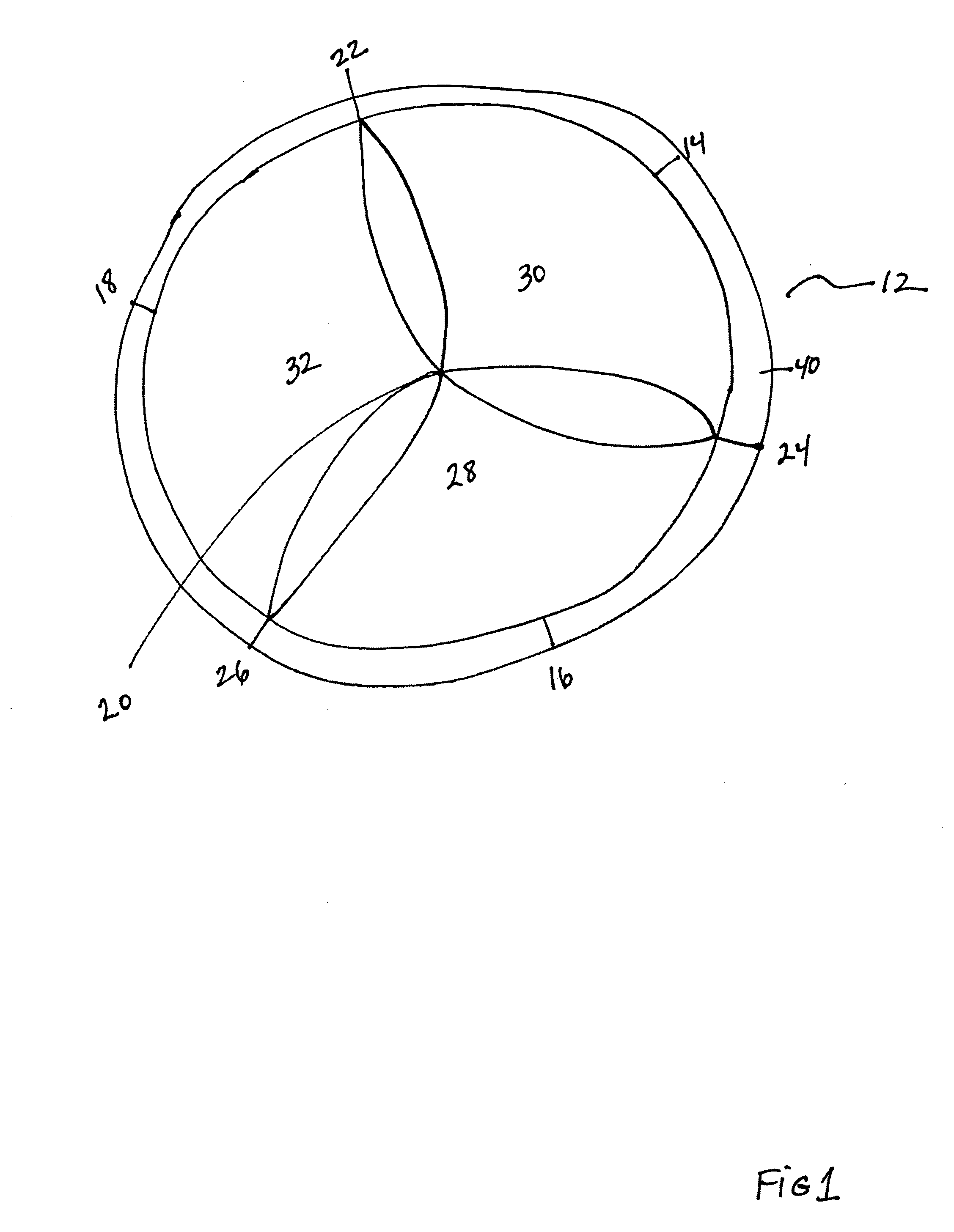 Sewing Ring for a Prosthetic Tissue Valve